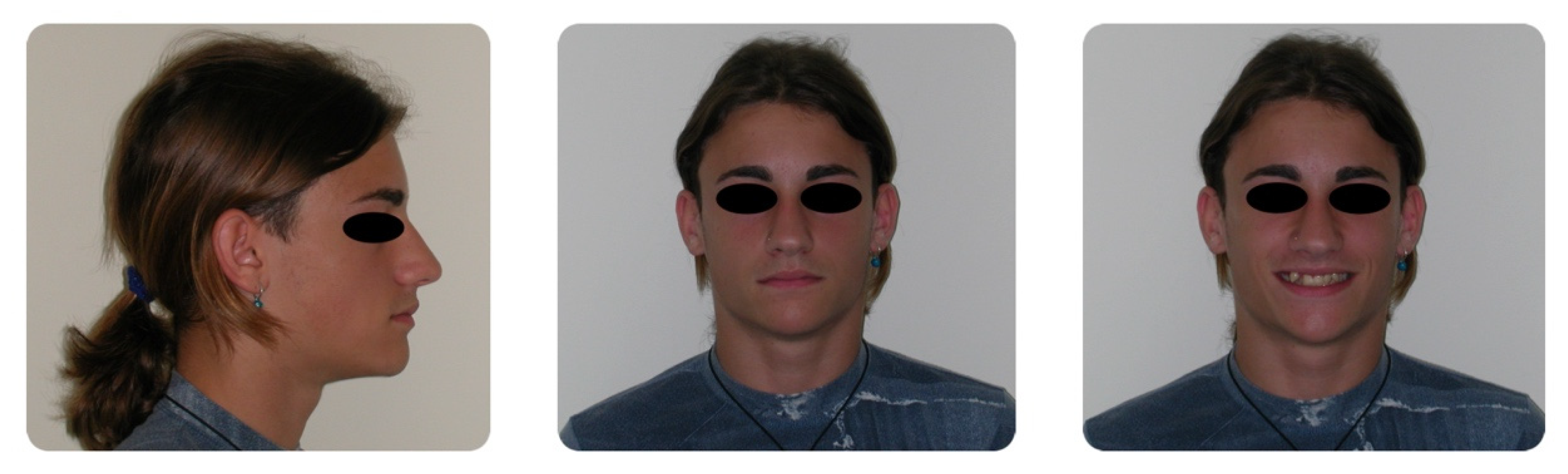 Dentistry 08 00041 g001 Dentistry 08 00041 g001