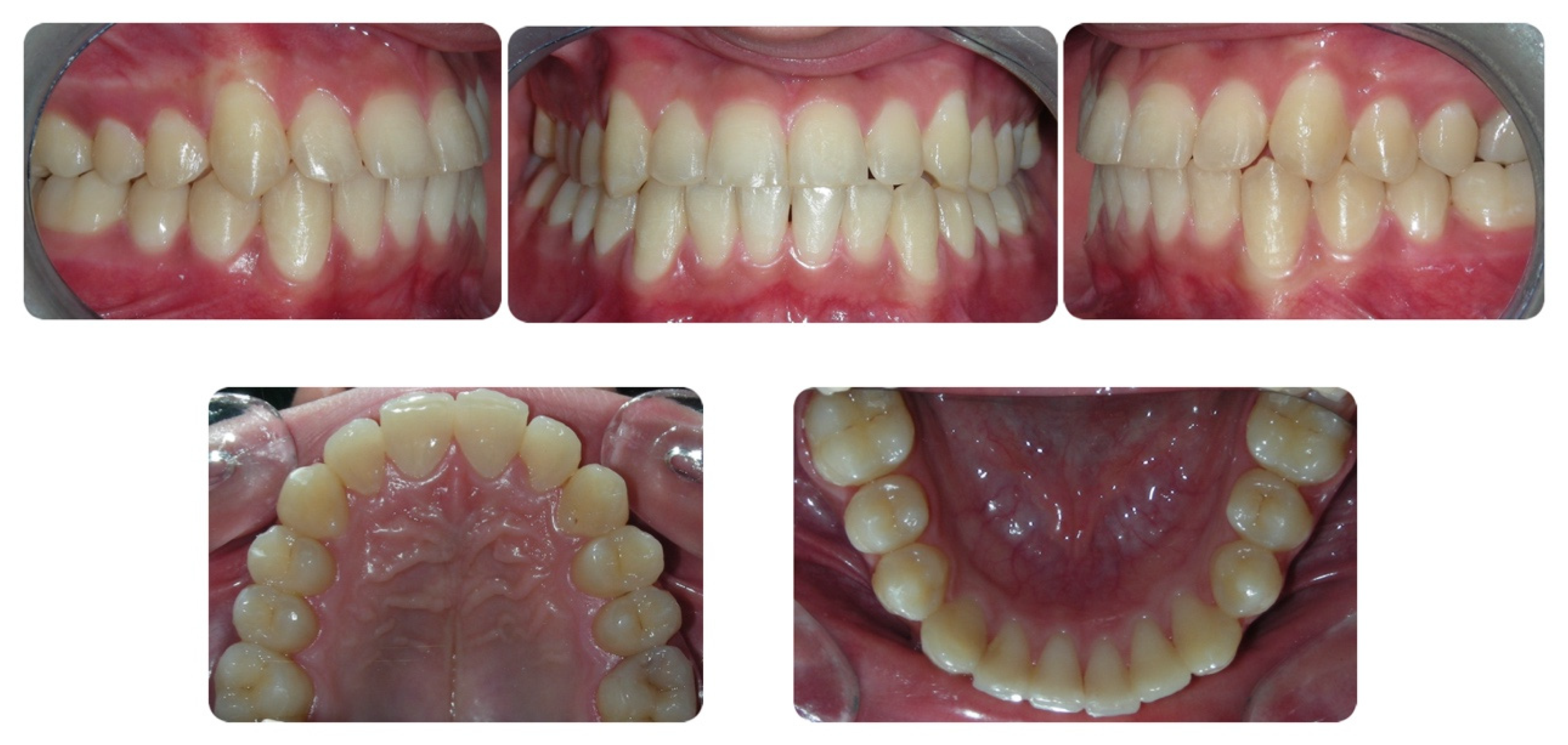 Dentistry Journal Free FullText A Full Diagnostic Process for the
