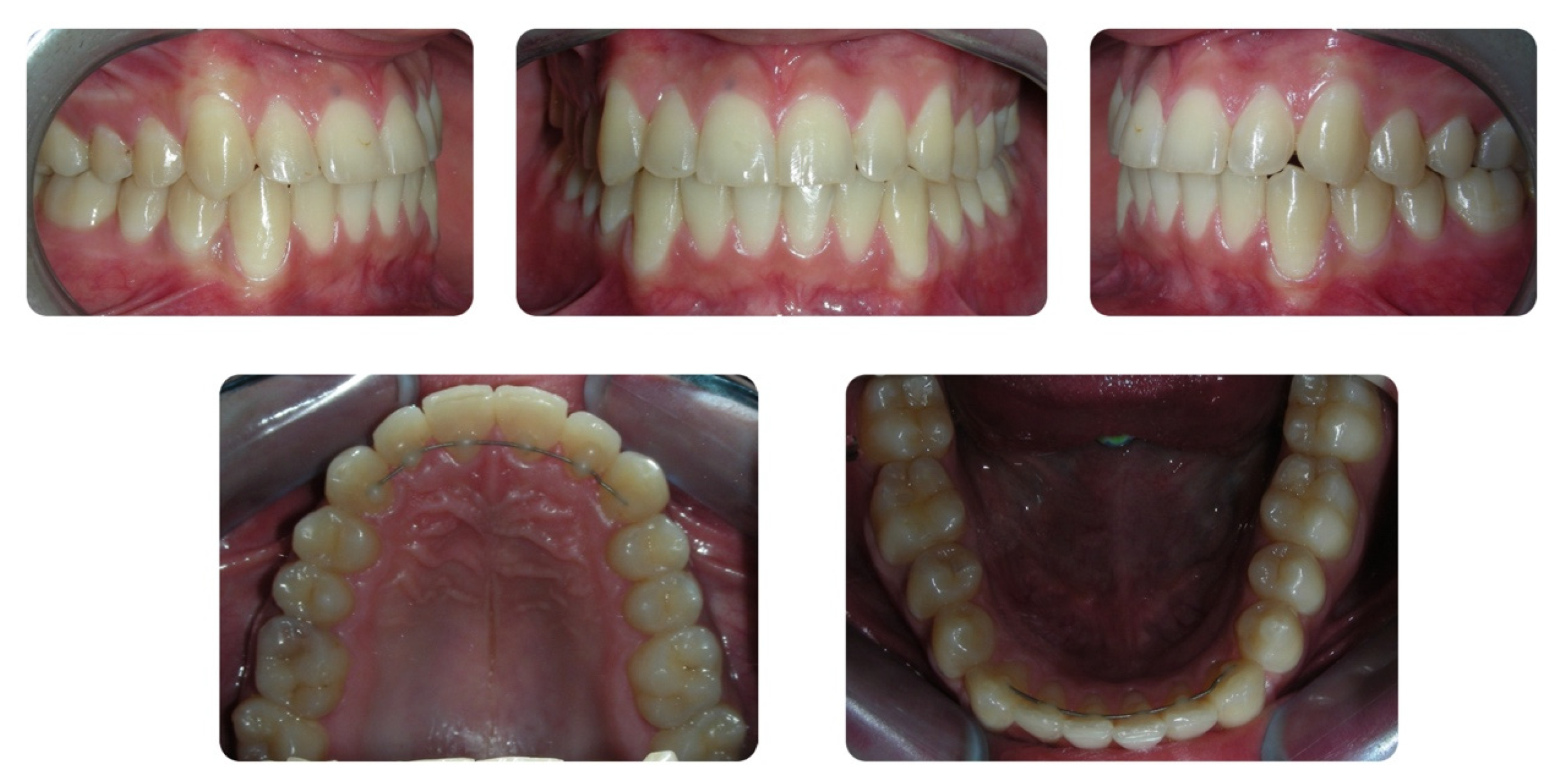 Dentistry 08 00041 g012 Dentistry 08 00041 g012