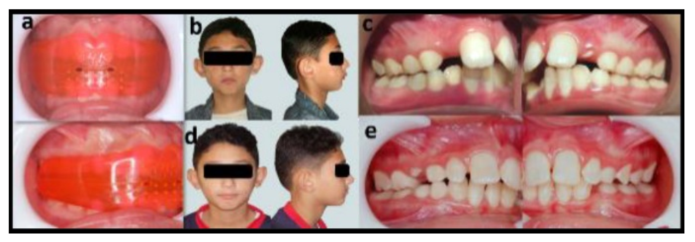 Dentistry 08 00044 g003 Dentistry 08 00044 g003