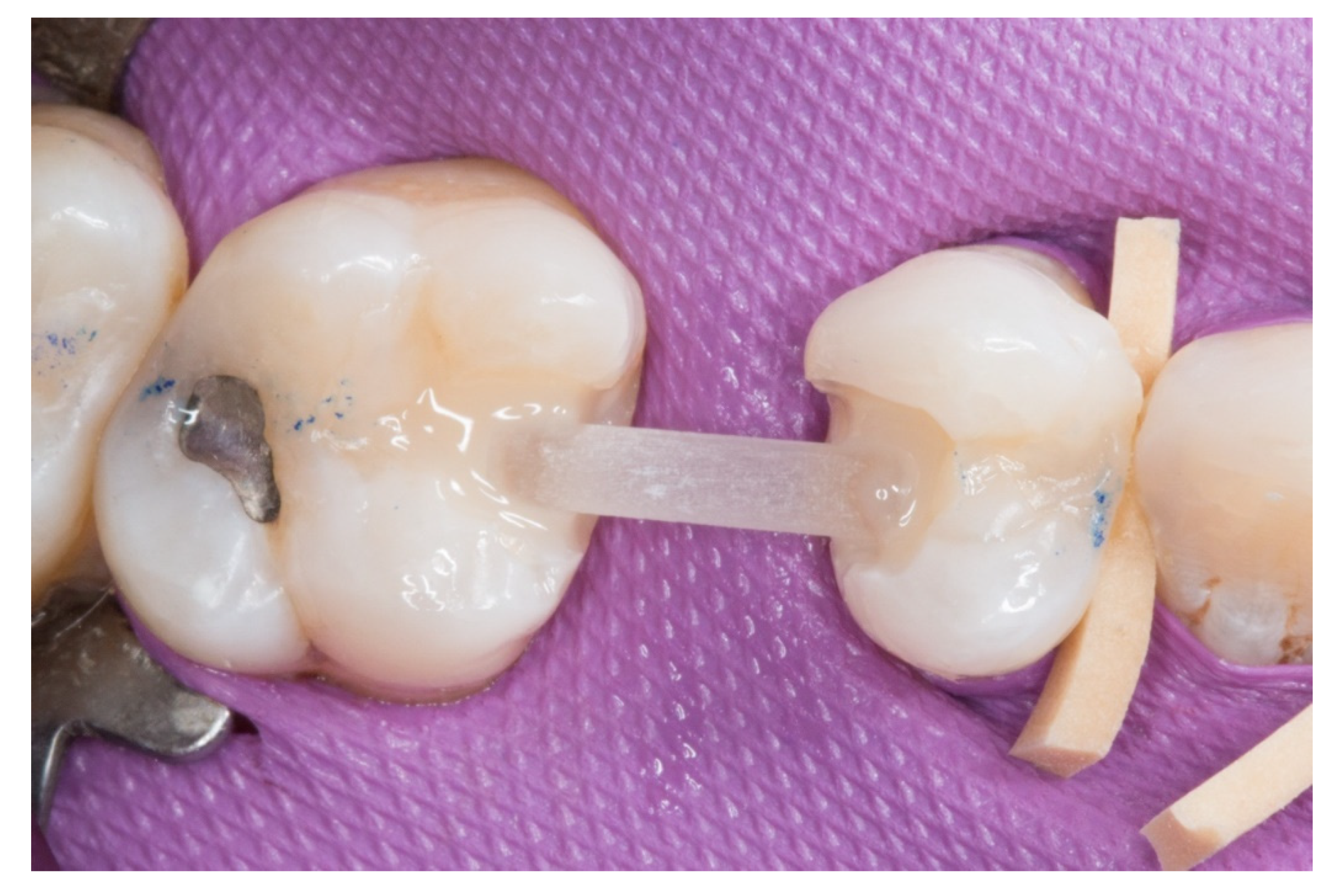 Dentistry 08 00048 g004 Dentistry 08 00048 g004