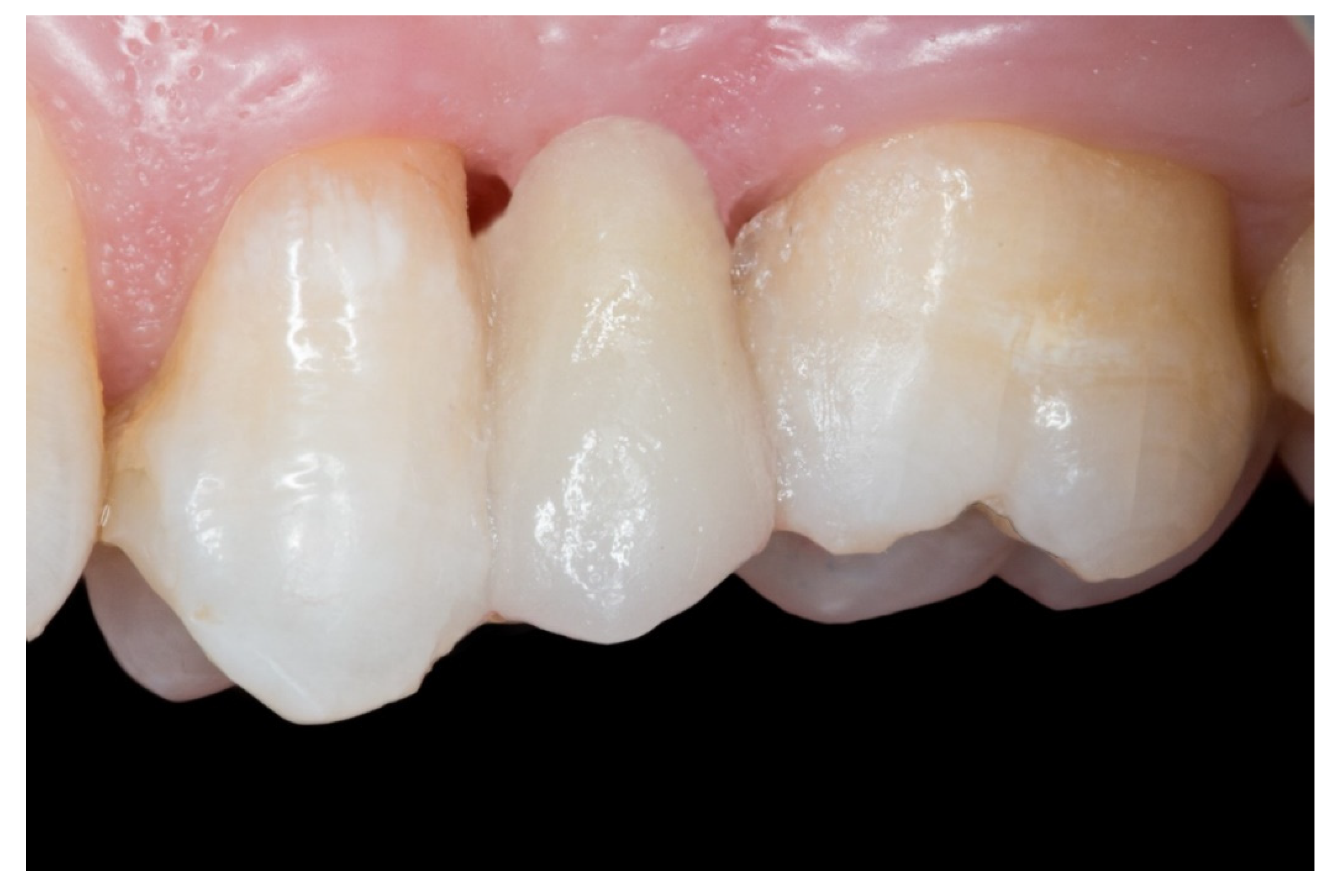 Dentistry 08 00048 g007 Dentistry 08 00048 g007