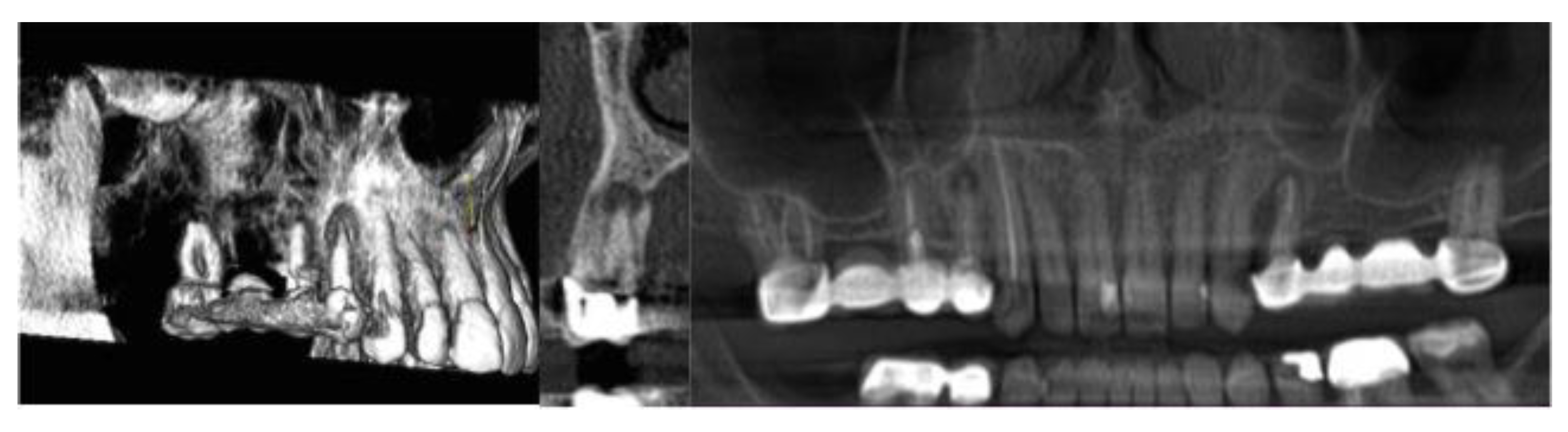 Dentistry 08 00051 g002 Dentistry 08 00051 g002