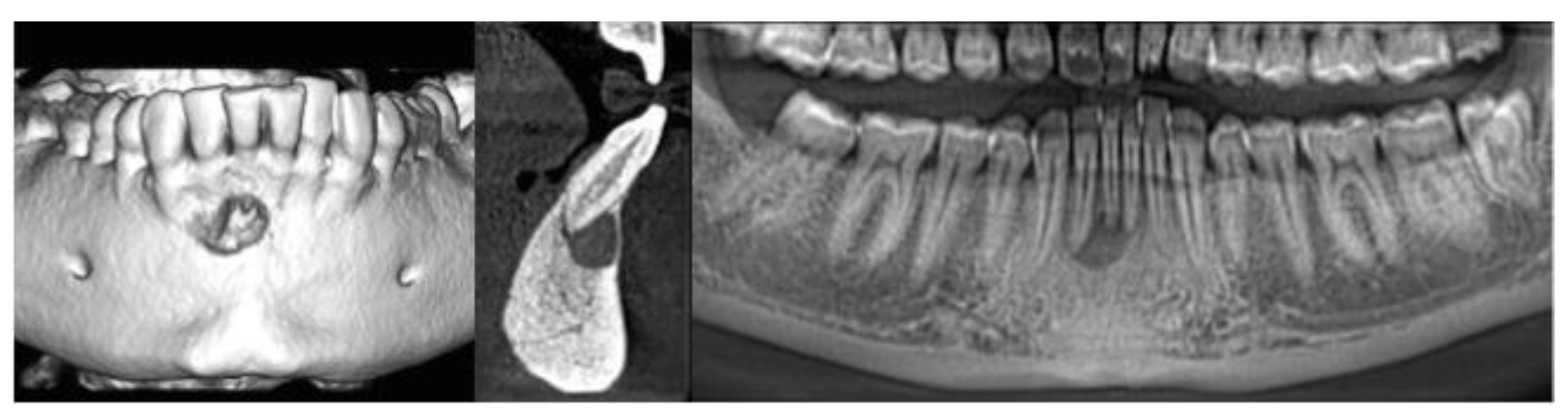 Dentistry 08 00051 g003 Dentistry 08 00051 g003