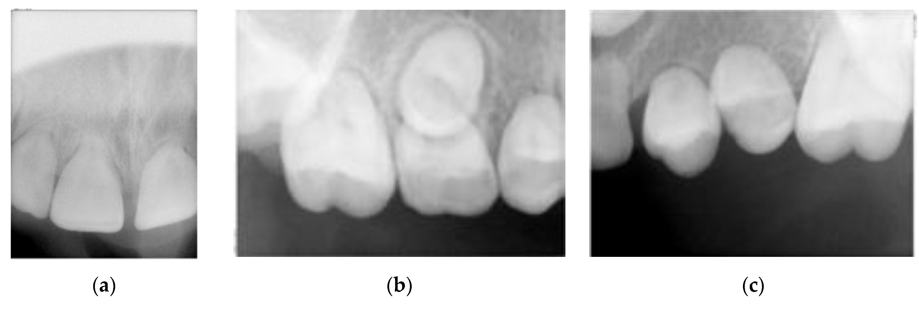 Dentistry 08 00059 g003 Dentistry 08 00059 g003