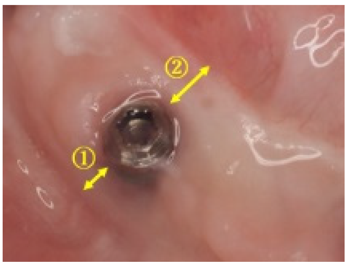 Dentistry 08 00067 g001 Dentistry 08 00067 g001