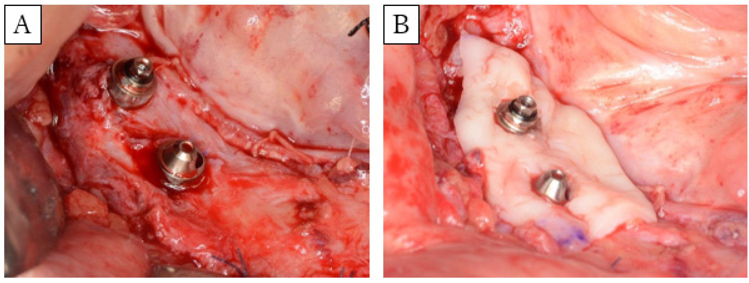 Dentistry 08 00067 g002 Dentistry 08 00067 g002