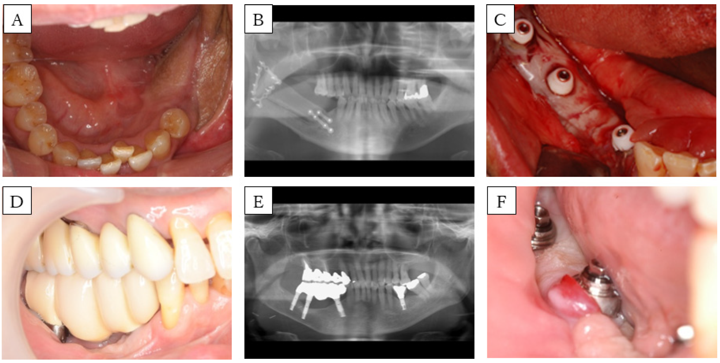 Dentistry 08 00067 g003 Dentistry 08 00067 g003