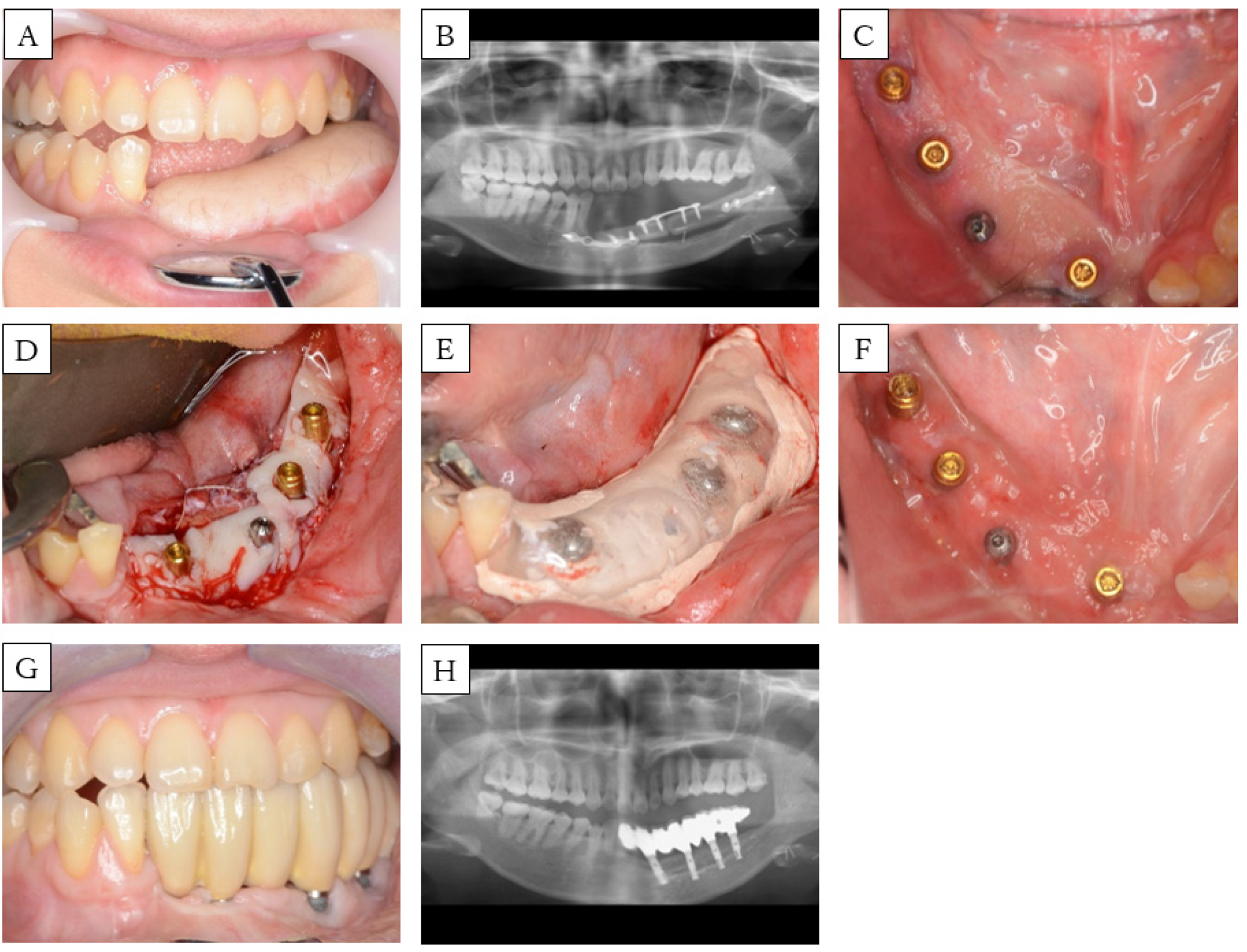 Dentistry 08 00067 g004 Dentistry 08 00067 g004