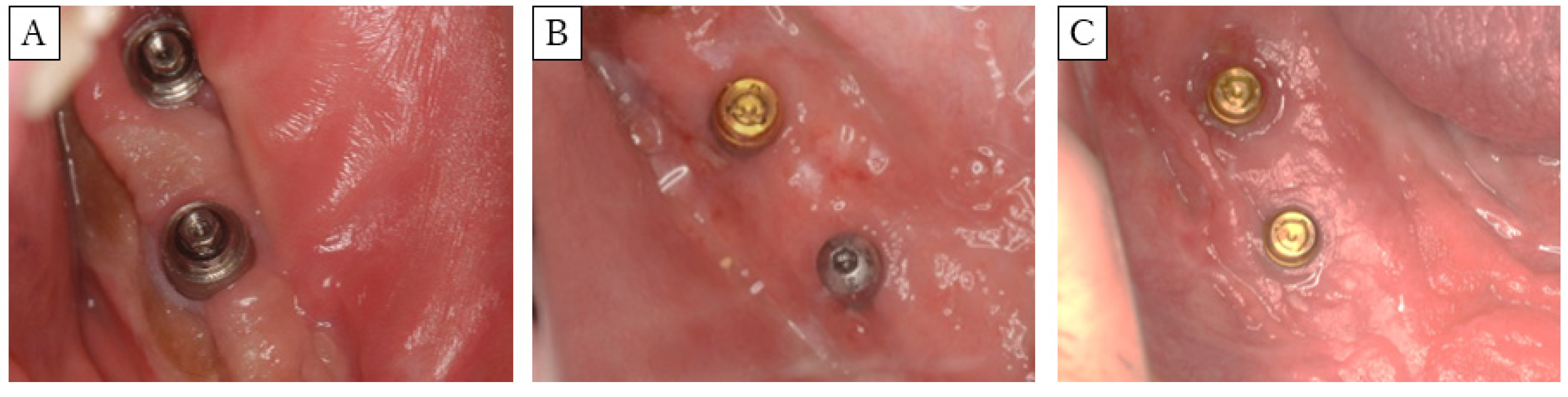 Dentistry 08 00067 g006 Dentistry 08 00067 g006