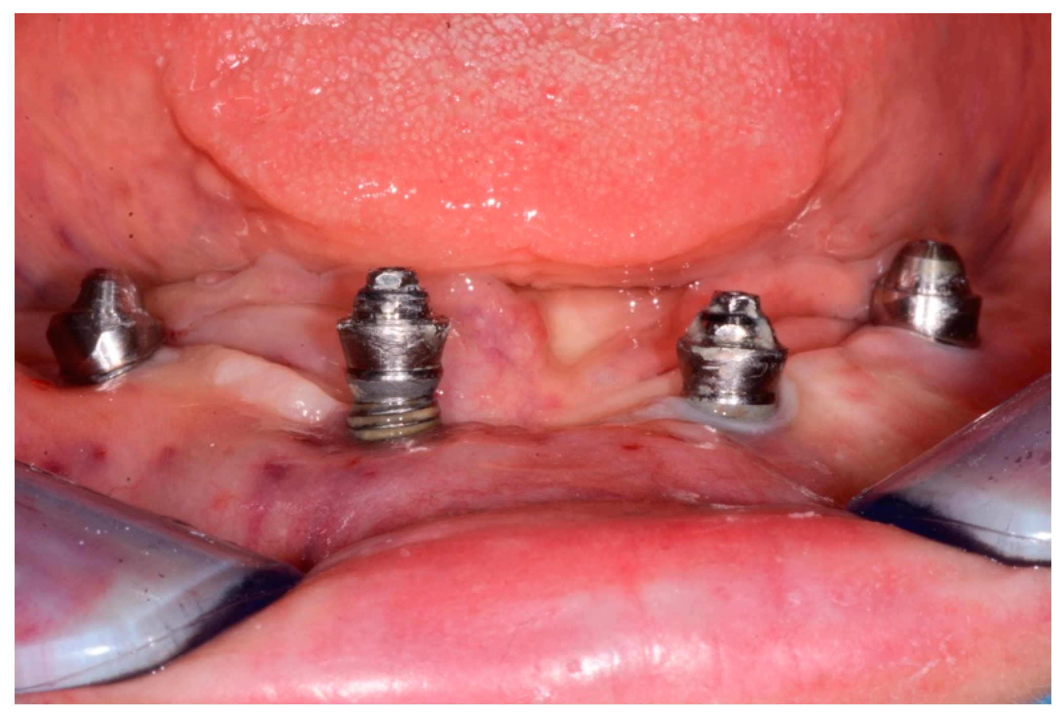 Dentistry 08 00070 g003