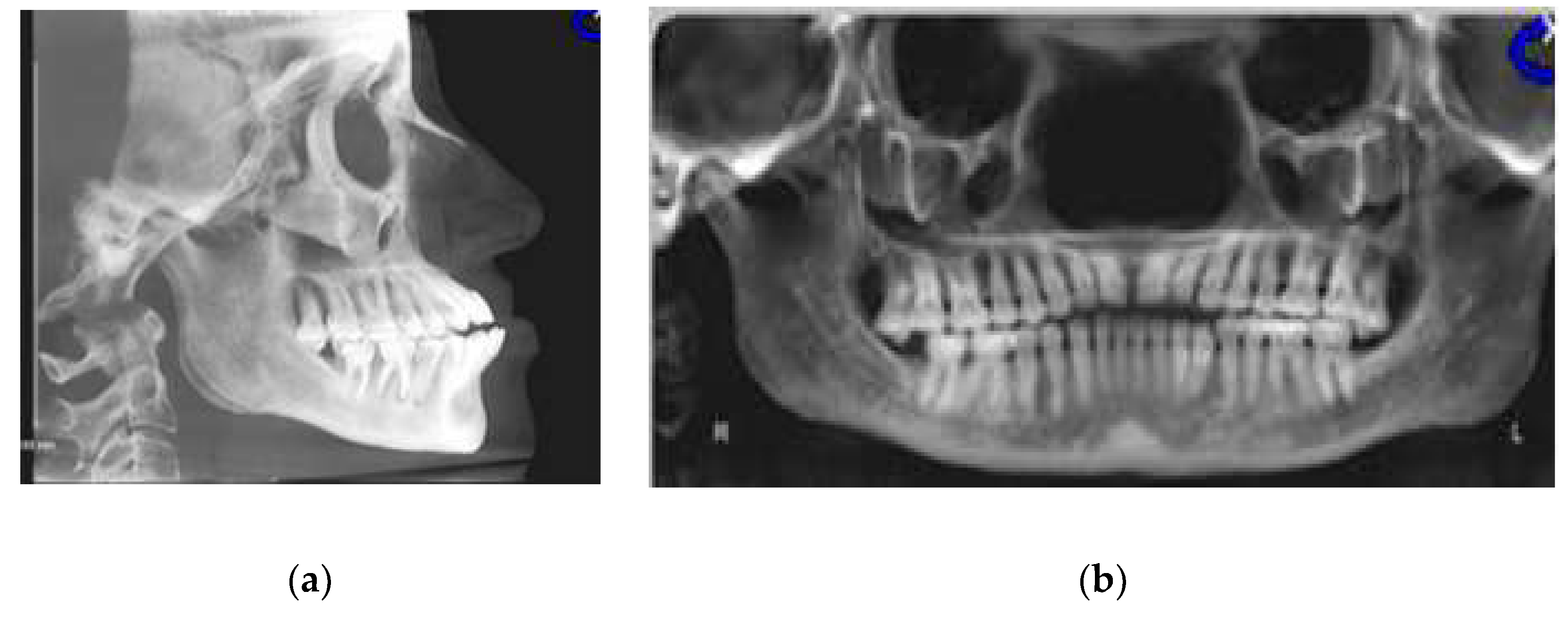 Dentistry 08 00075 g003