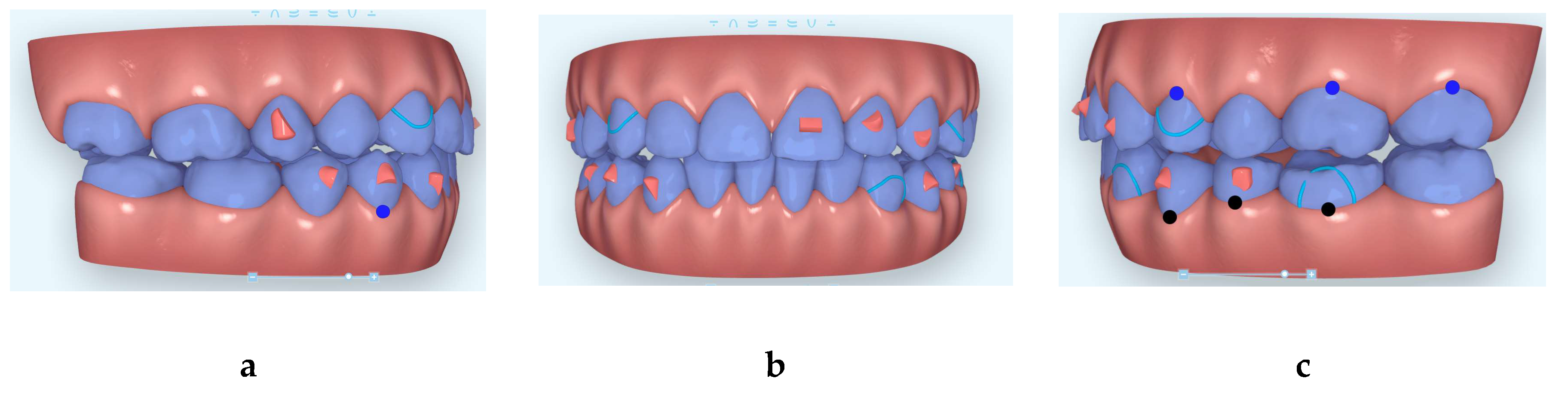 Dentistry 08 00075 g005