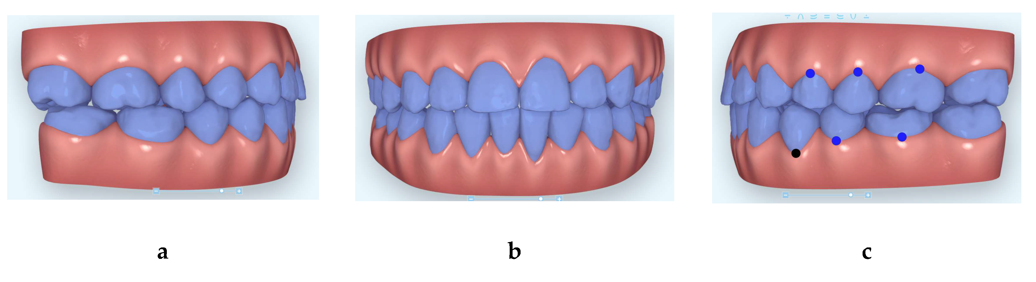 Dentistry 08 00075 g007