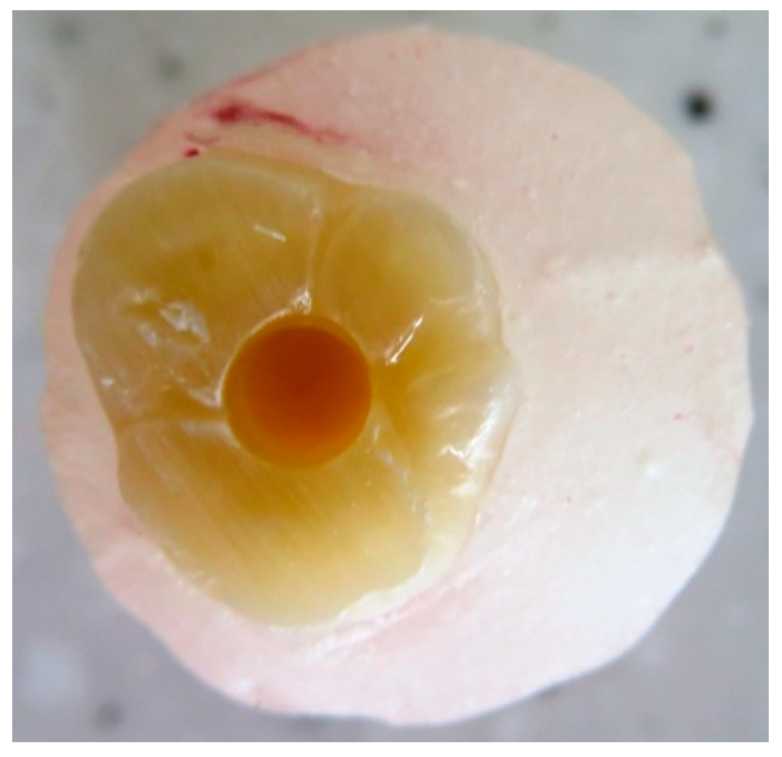 Dentistry 08 00076 g002 Dentistry 08 00076 g002