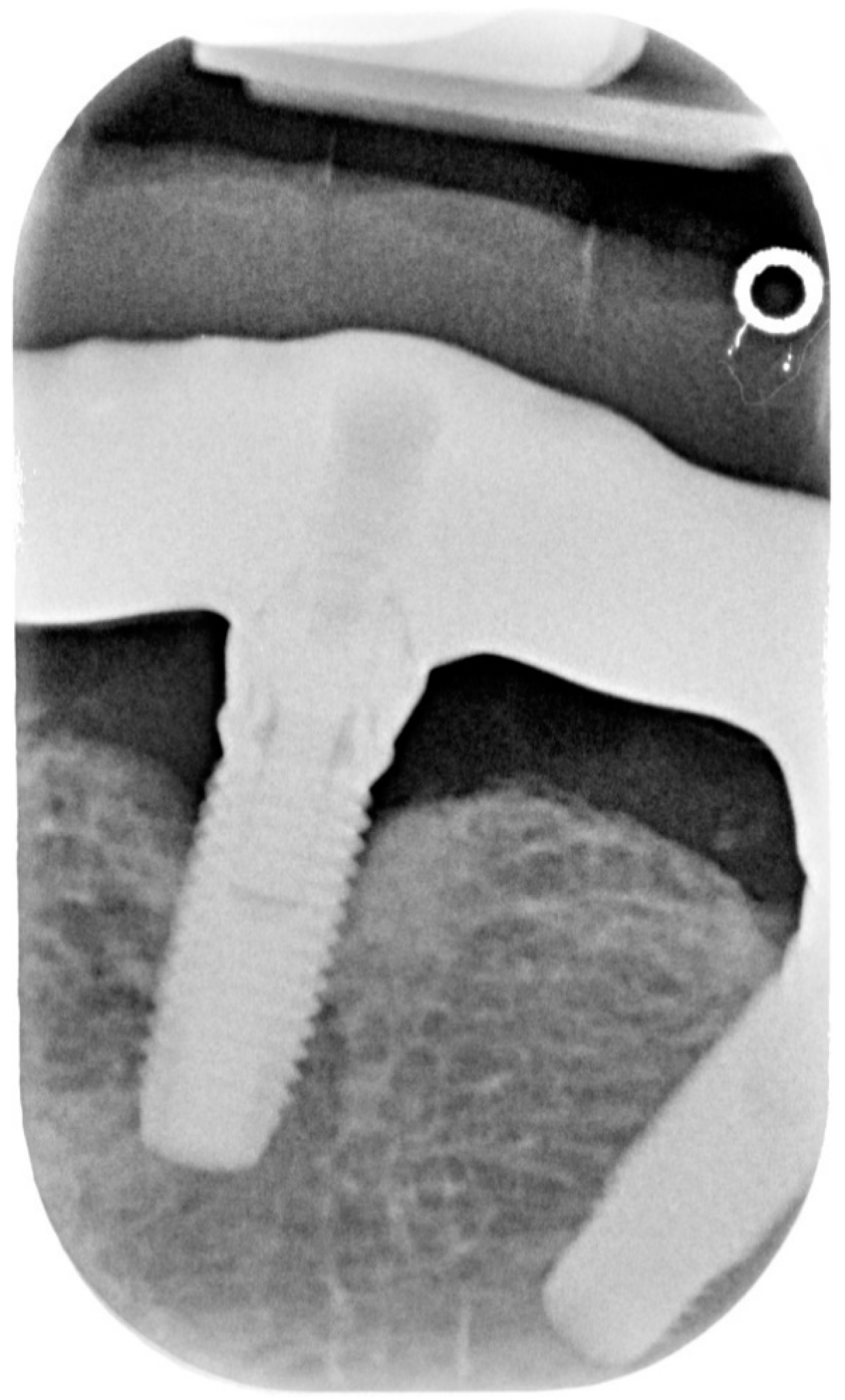 Dentistry 08 00078 g002 Dentistry 08 00078 g002