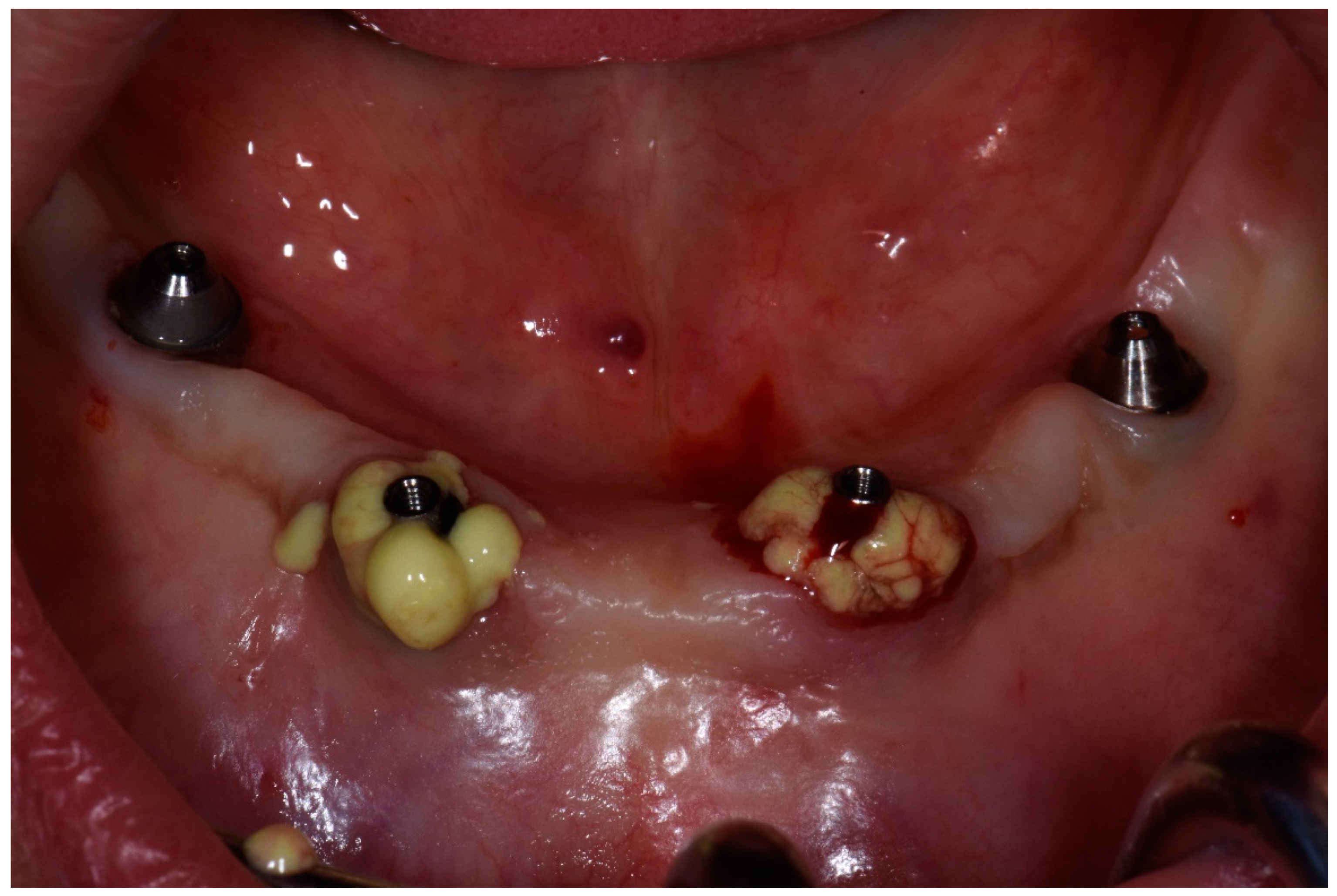 Dentistry 08 00078 g003 Dentistry 08 00078 g003