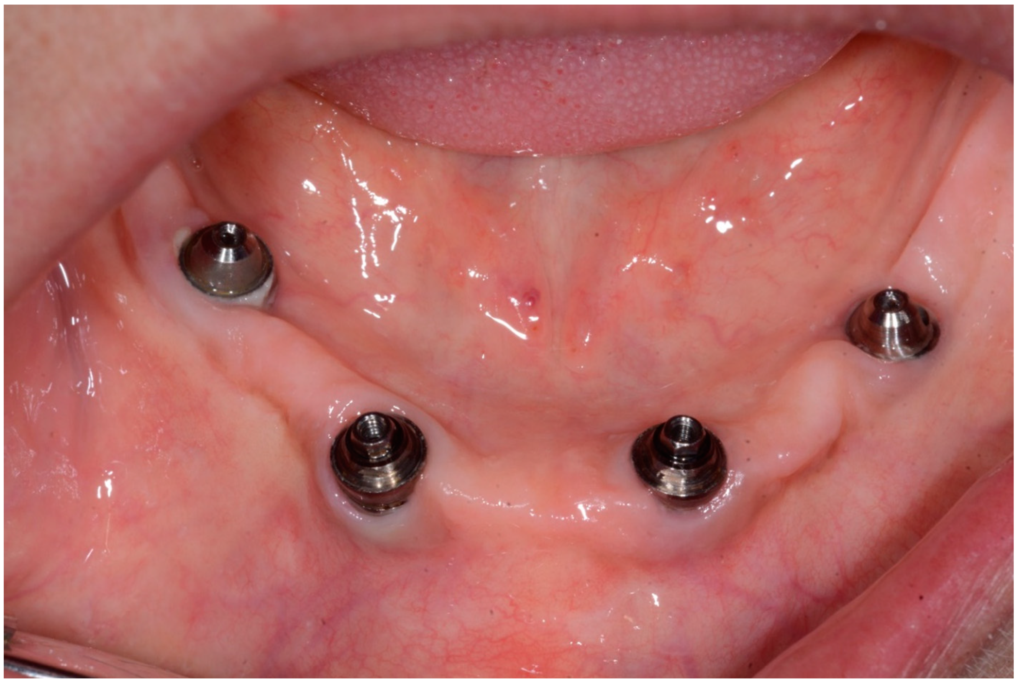 Dentistry 08 00078 g004 Dentistry 08 00078 g004