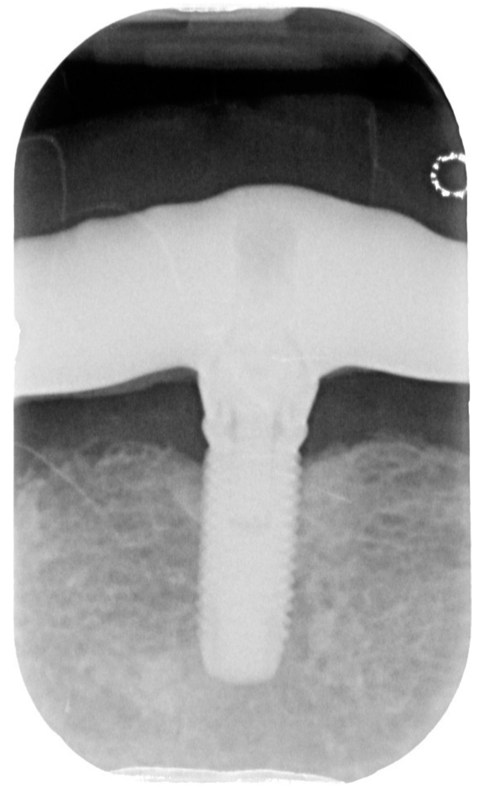 Dentistry 08 00078 g005 Dentistry 08 00078 g005