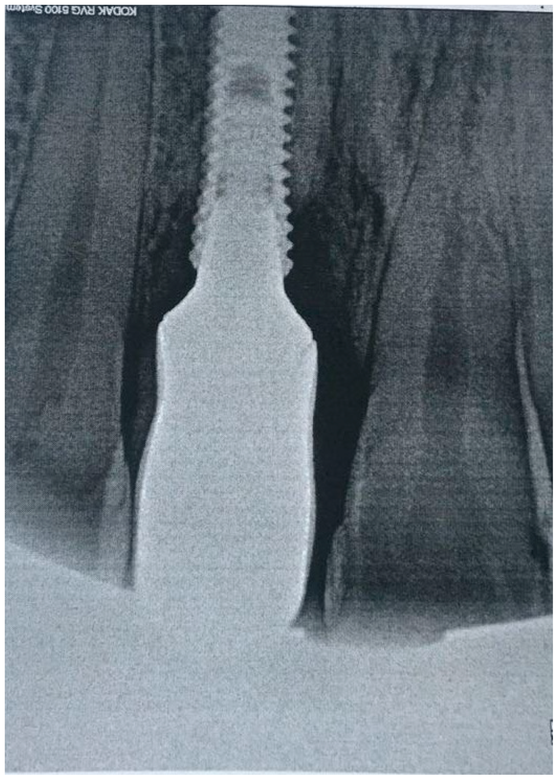 Dentistry 08 00078 g006 Dentistry 08 00078 g006