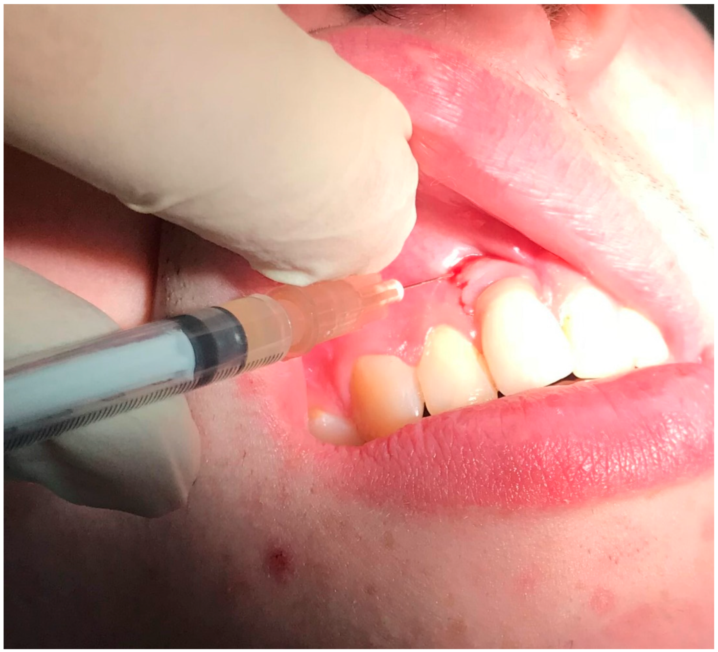 Dentistry 08 00078 g007 Dentistry 08 00078 g007