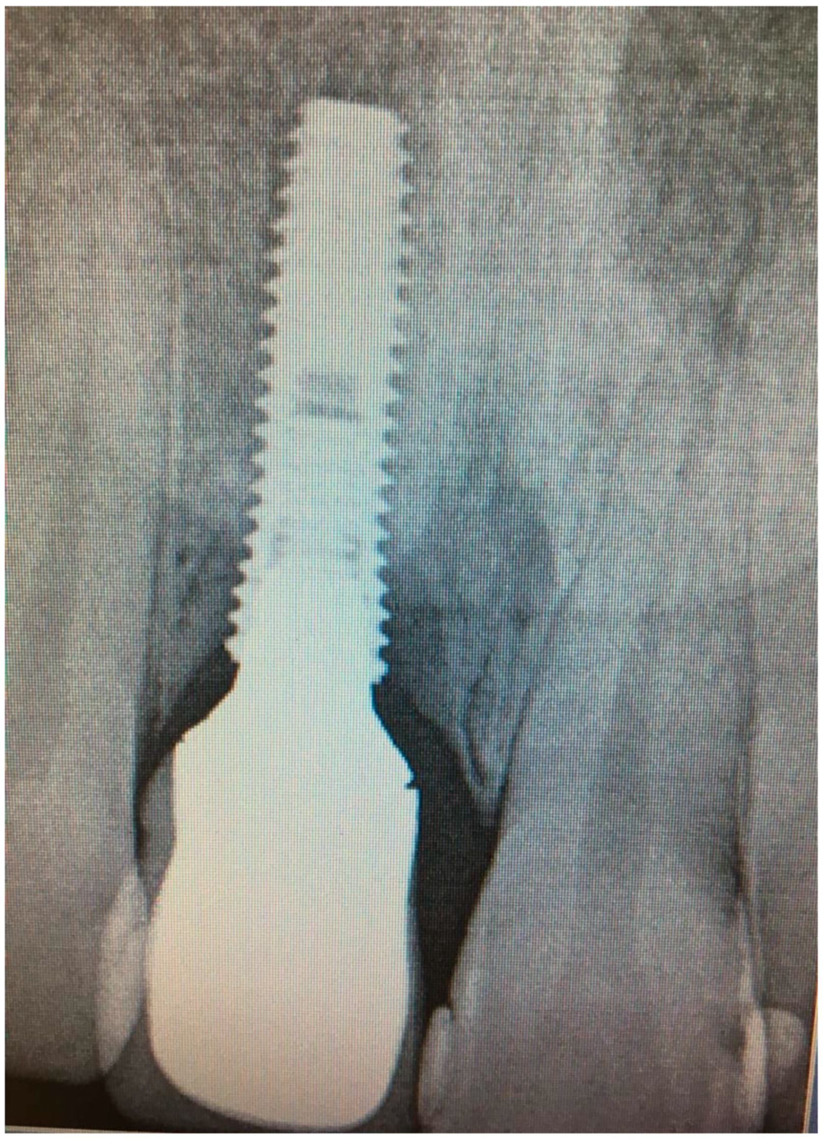 Dentistry 08 00078 g009 Dentistry 08 00078 g009