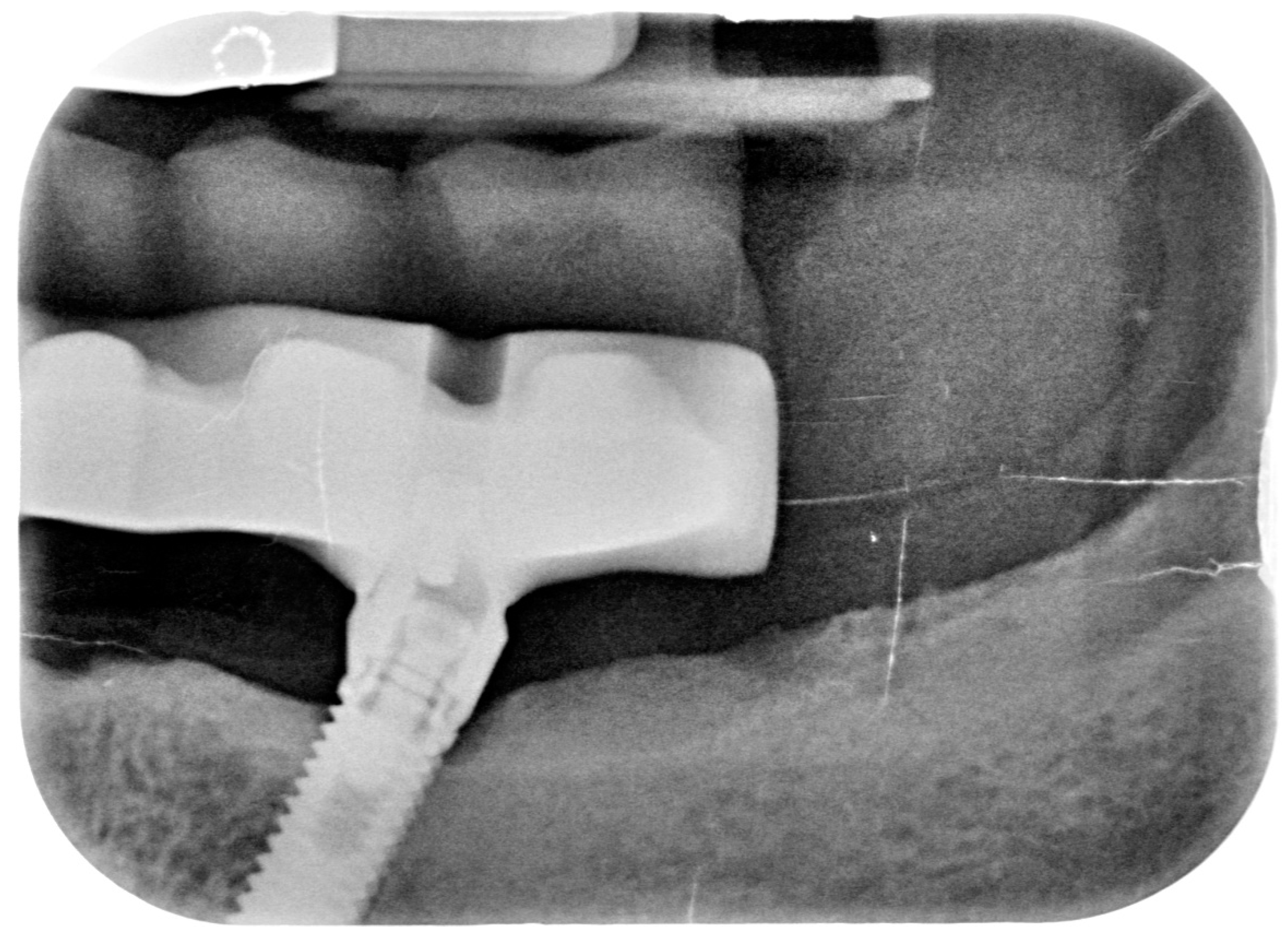 Dentistry 08 00078 g010 Dentistry 08 00078 g010