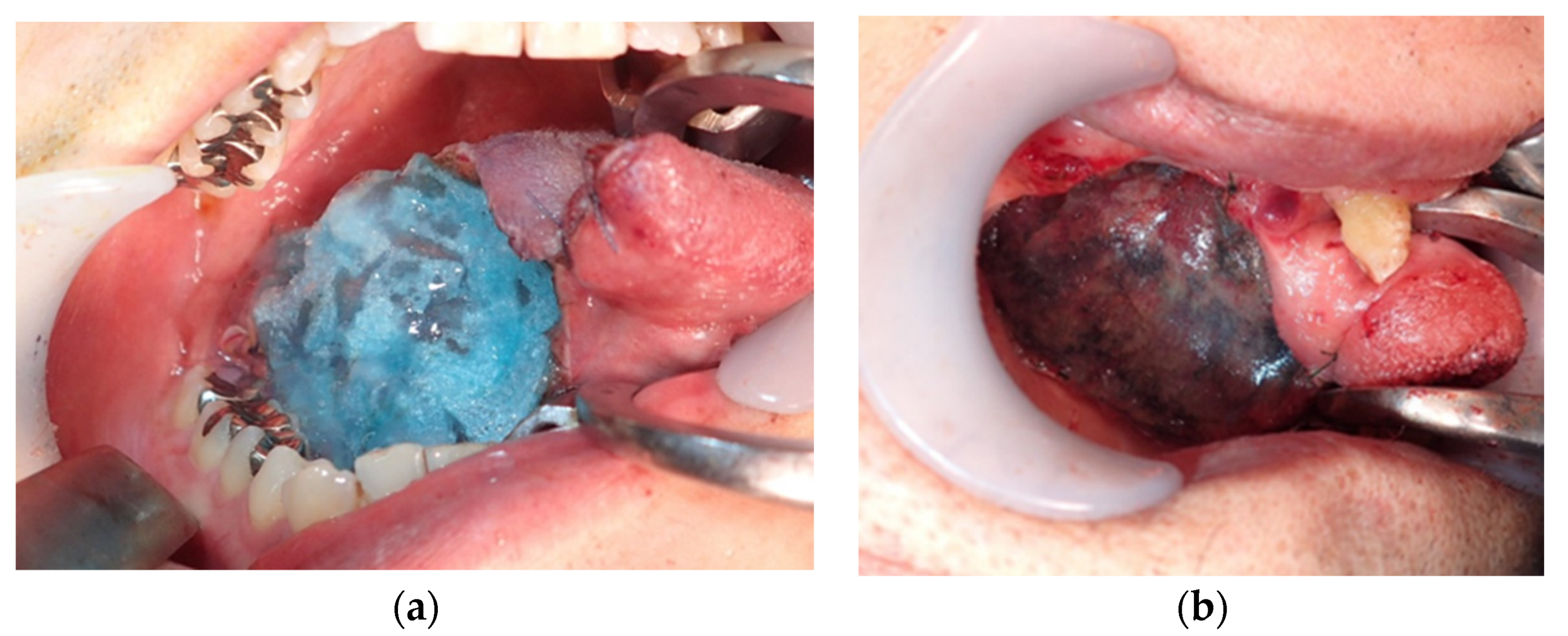 Dentistry 08 00085 g001