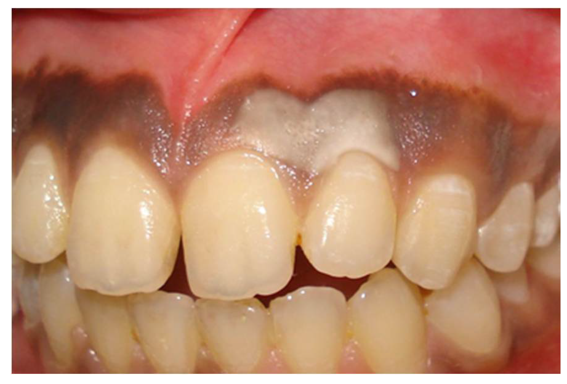 Dentistry 08 00088 g002