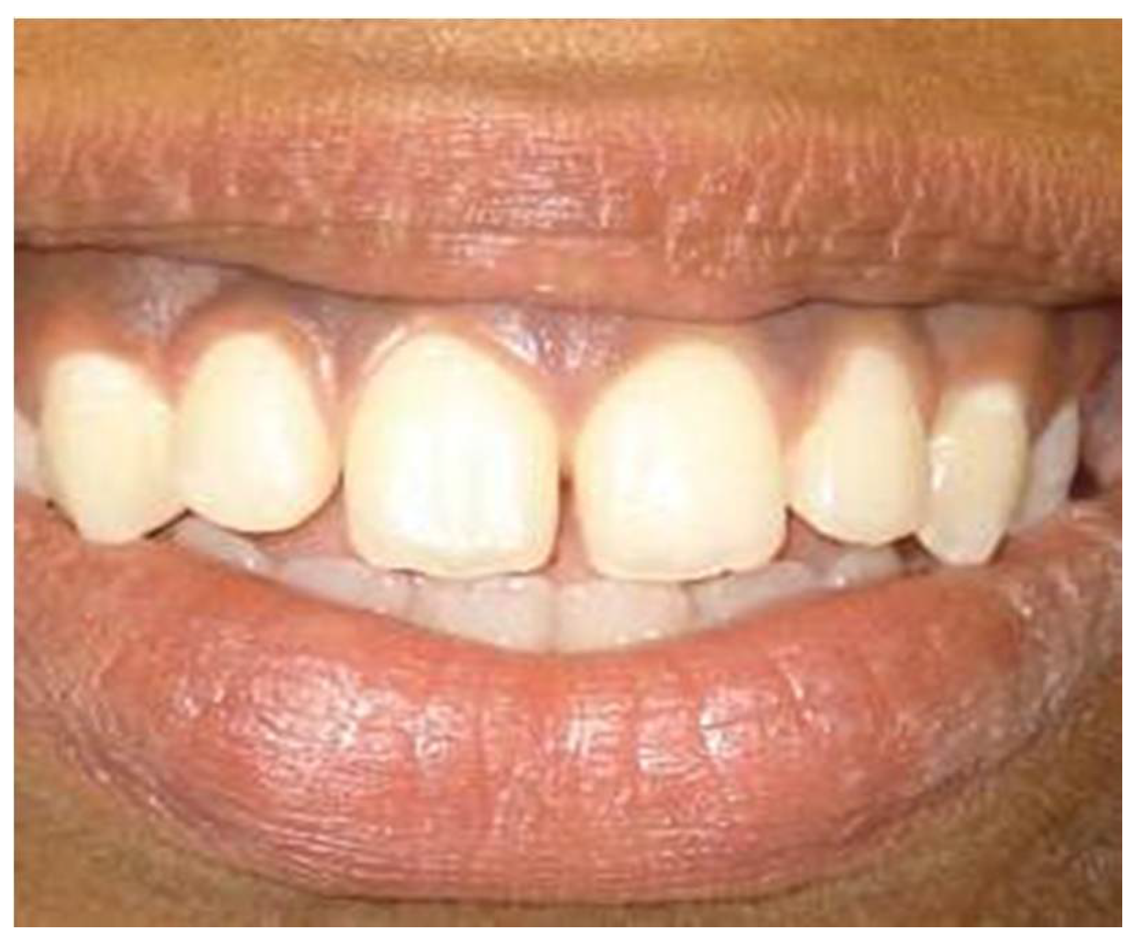 Dentistry 08 00088 g003