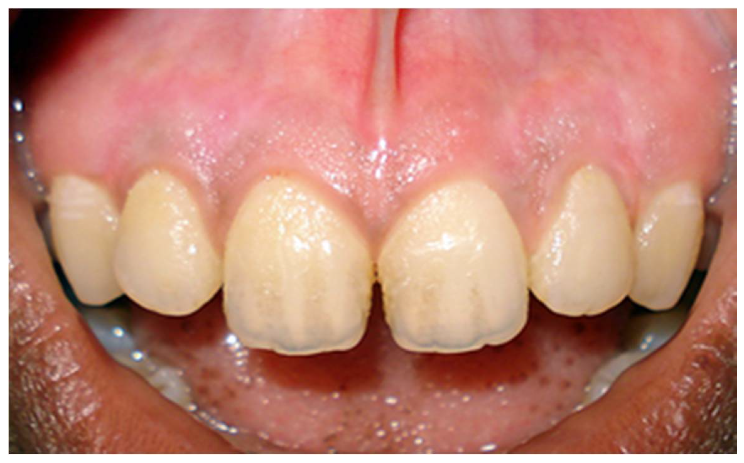 Dentistry 08 00088 g004