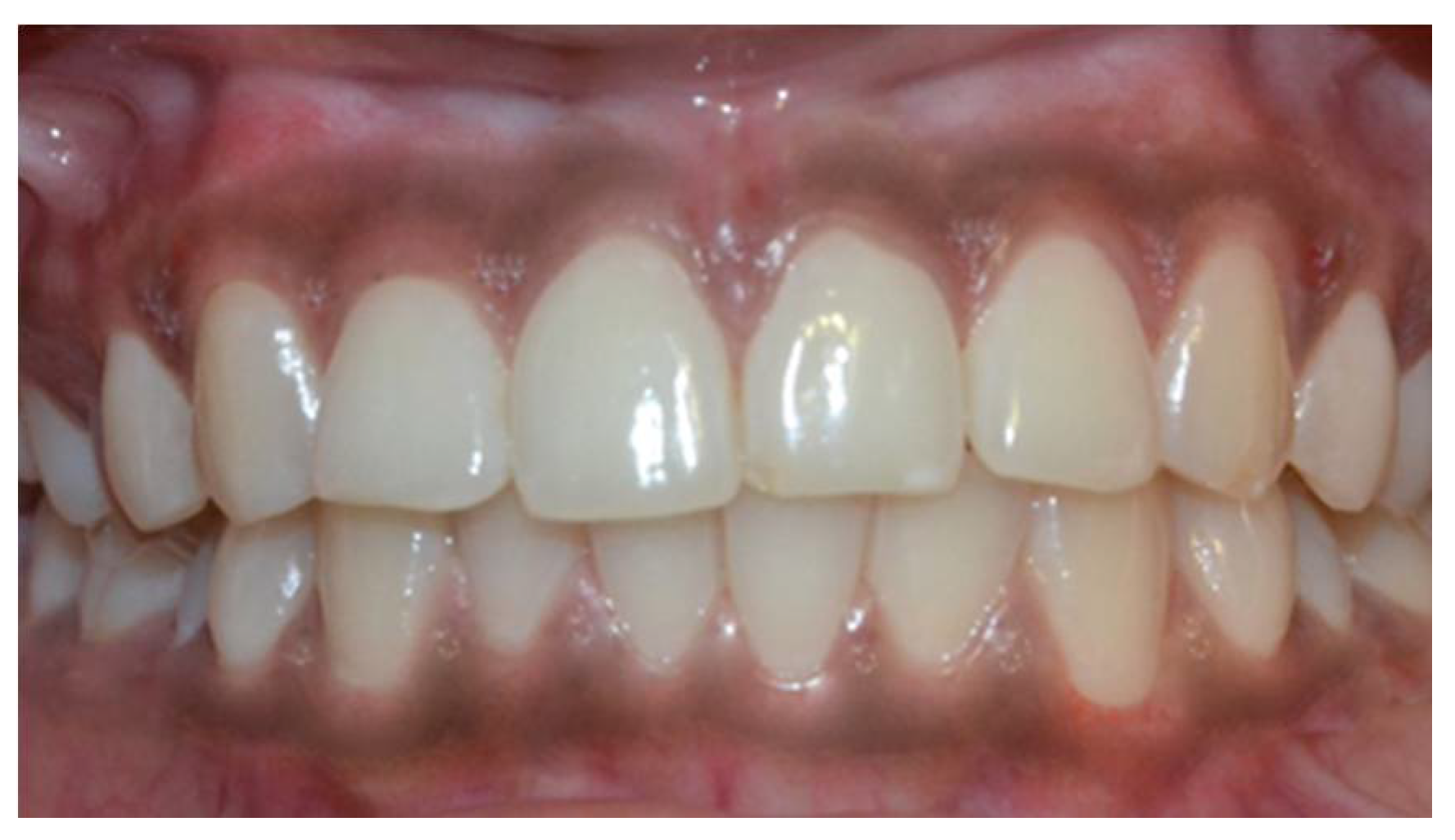 Dentistry 08 00088 g007