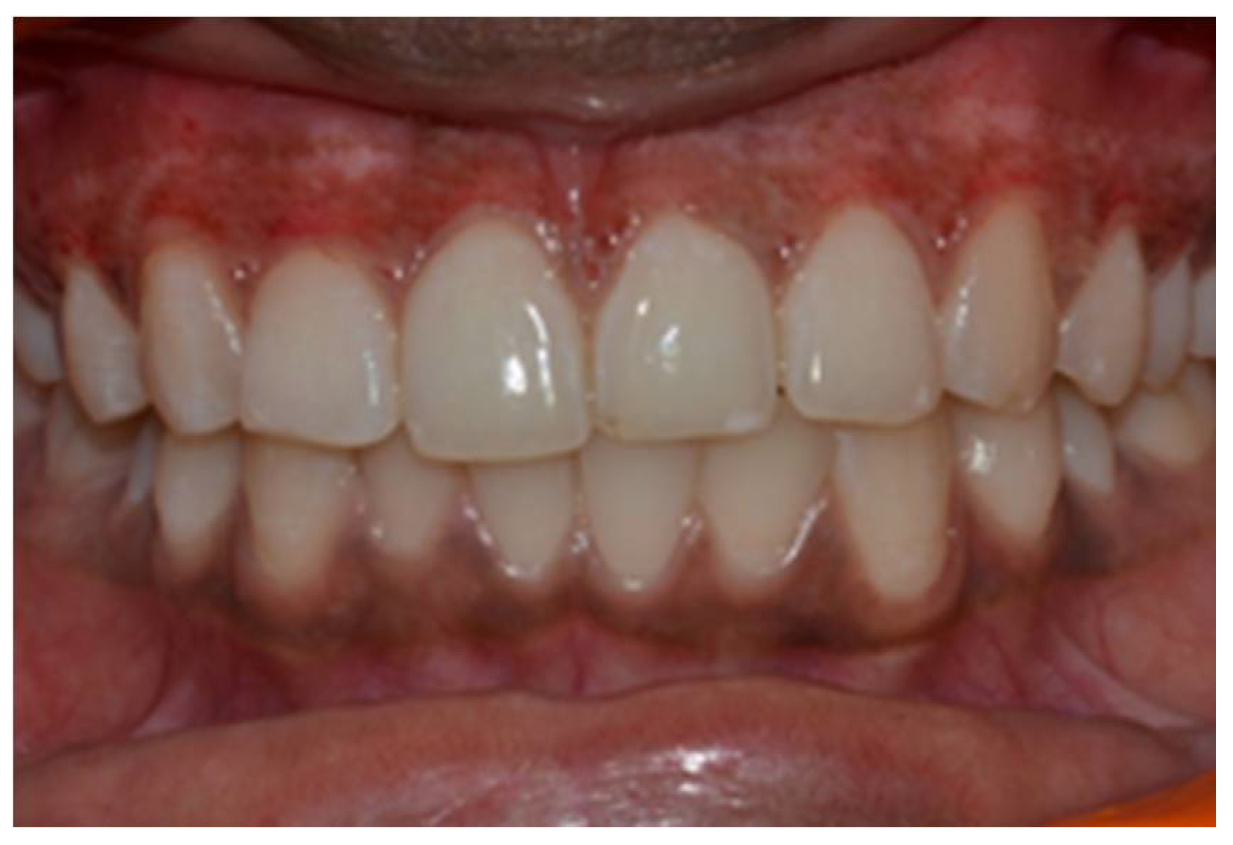 Dentistry 08 00088 g008