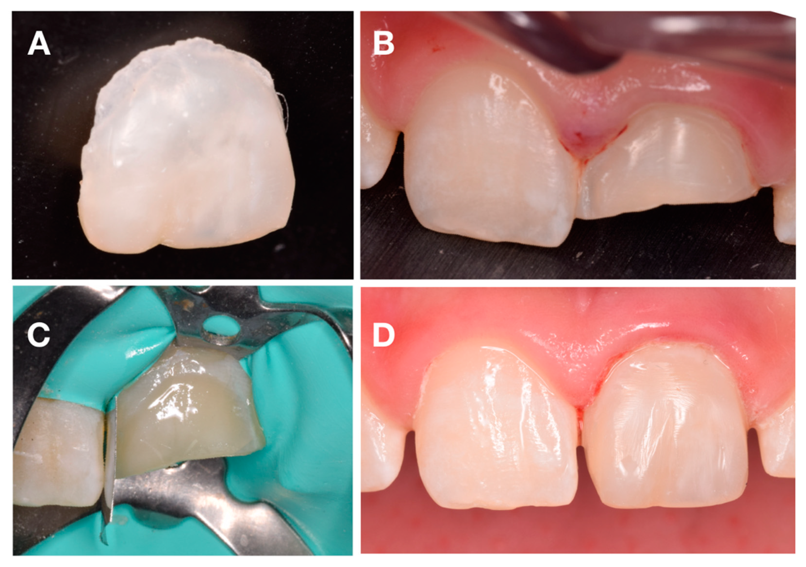 Dentistry 08 00094 g004