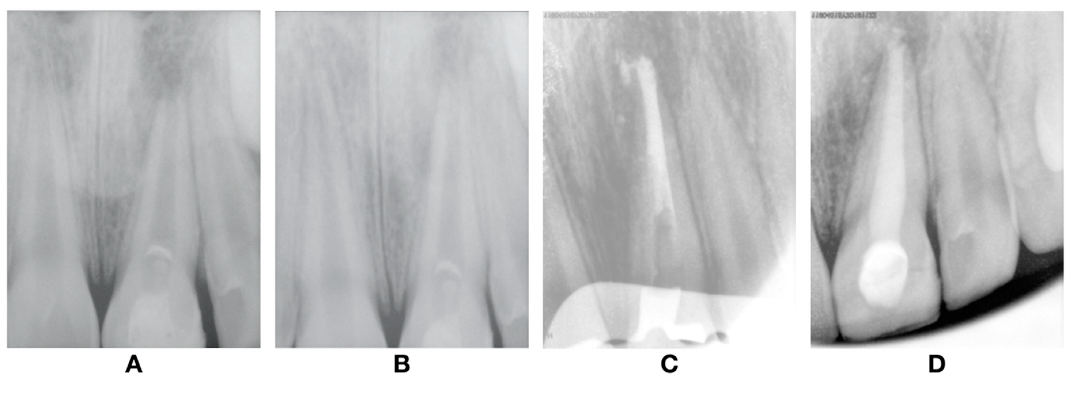 Dentistry 08 00094 g005