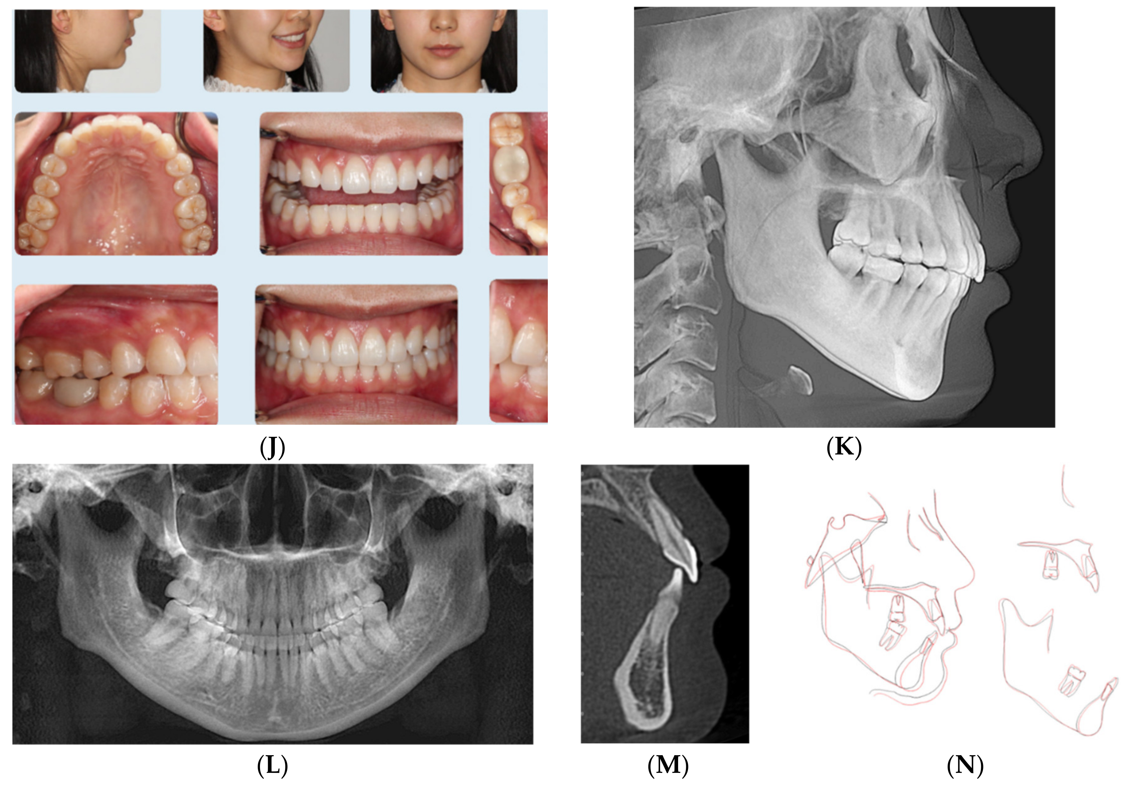 Dentistry 08 00110 g001b