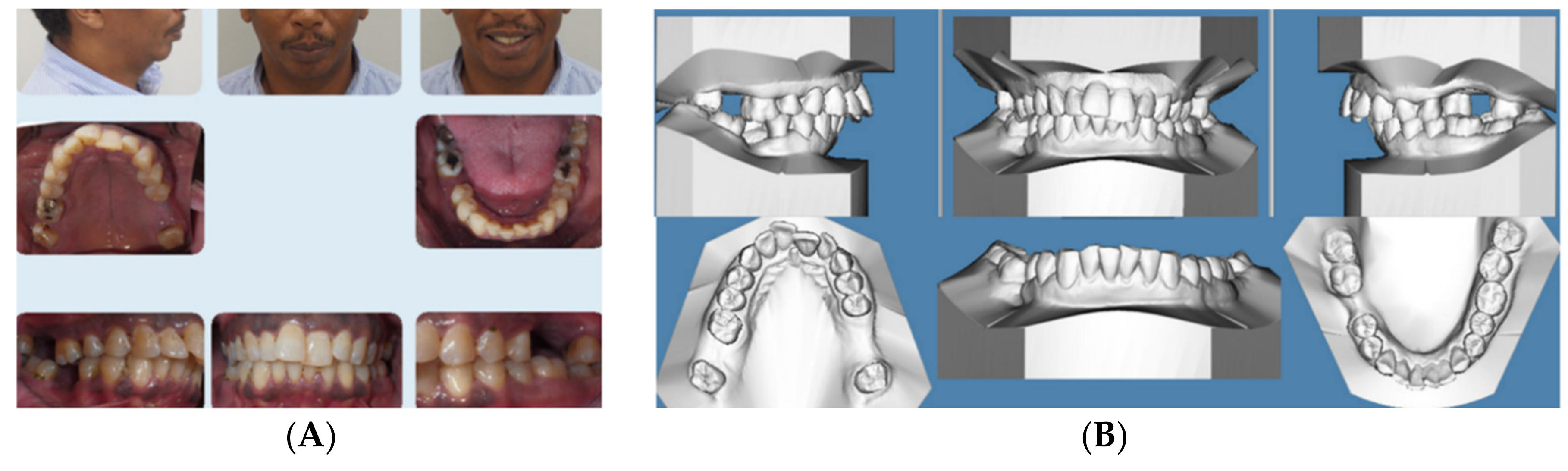 Dentistry 08 00110 g002a
