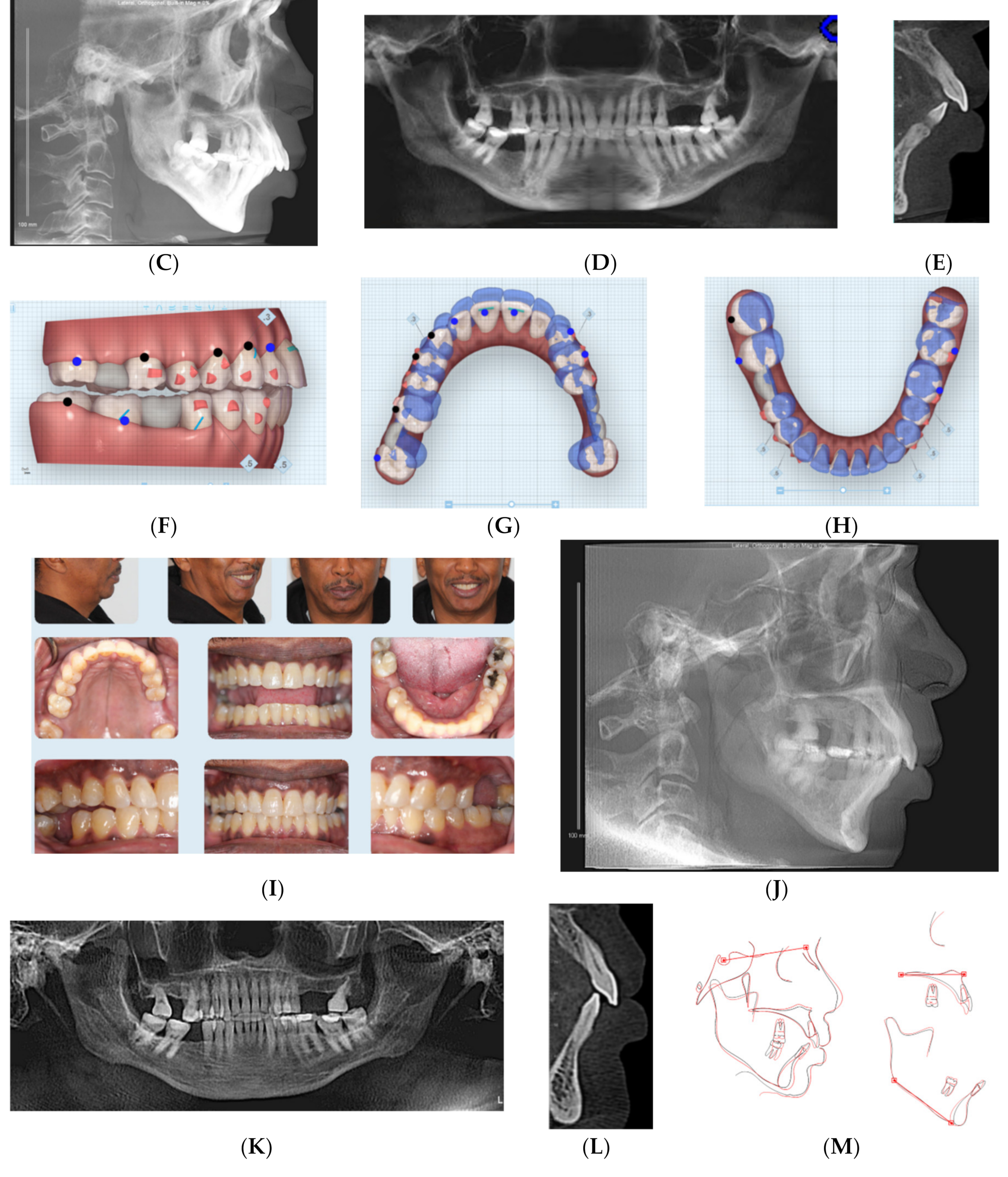 Dentistry 08 00110 g002b