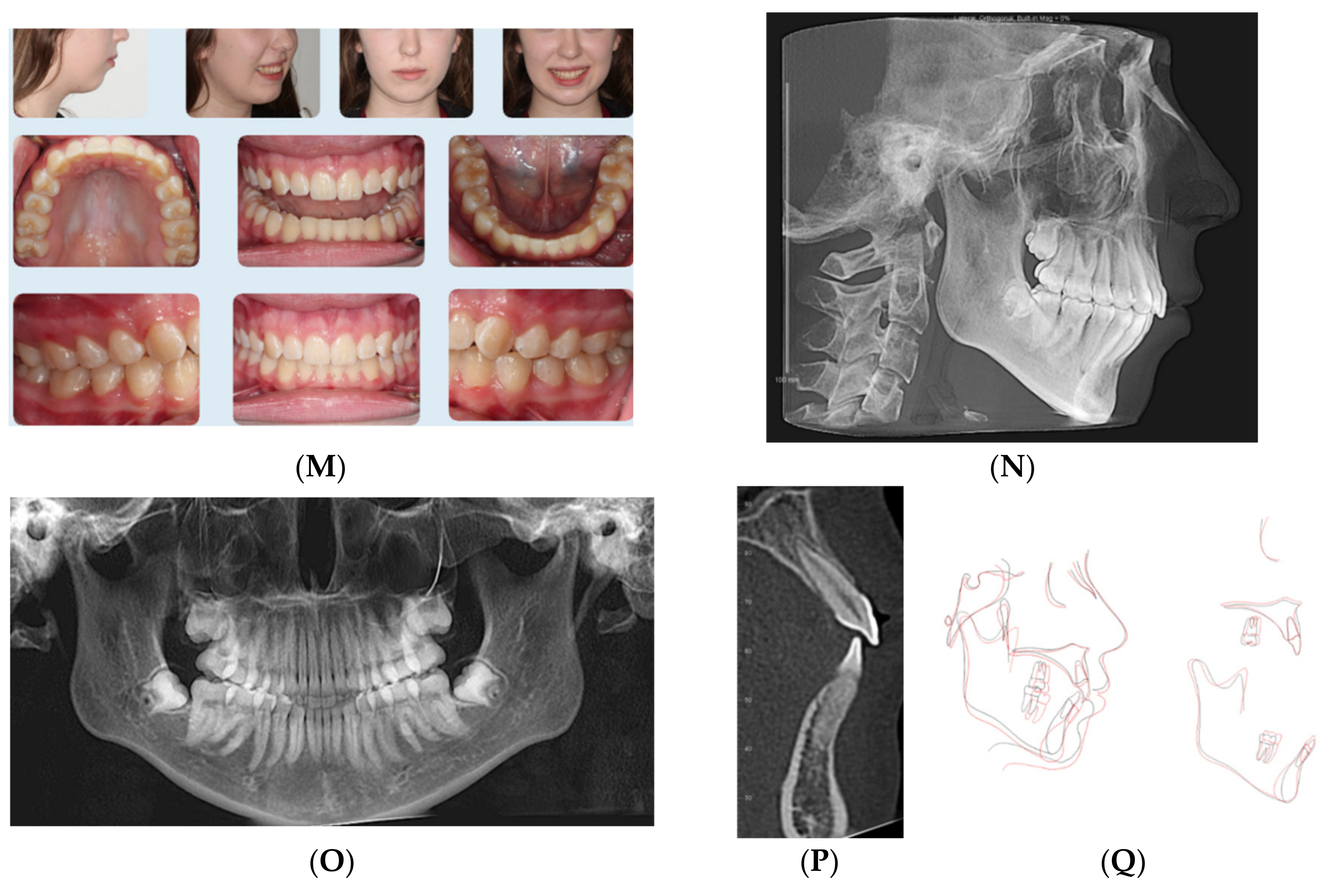 Dentistry 08 00110 g003b