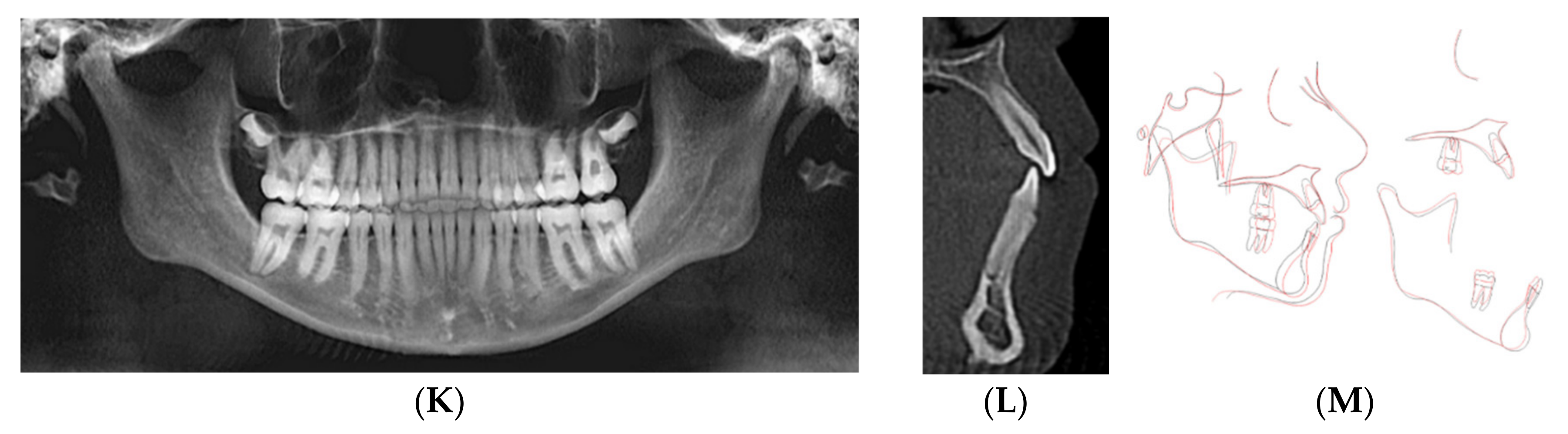 Dentistry 08 00110 g004b