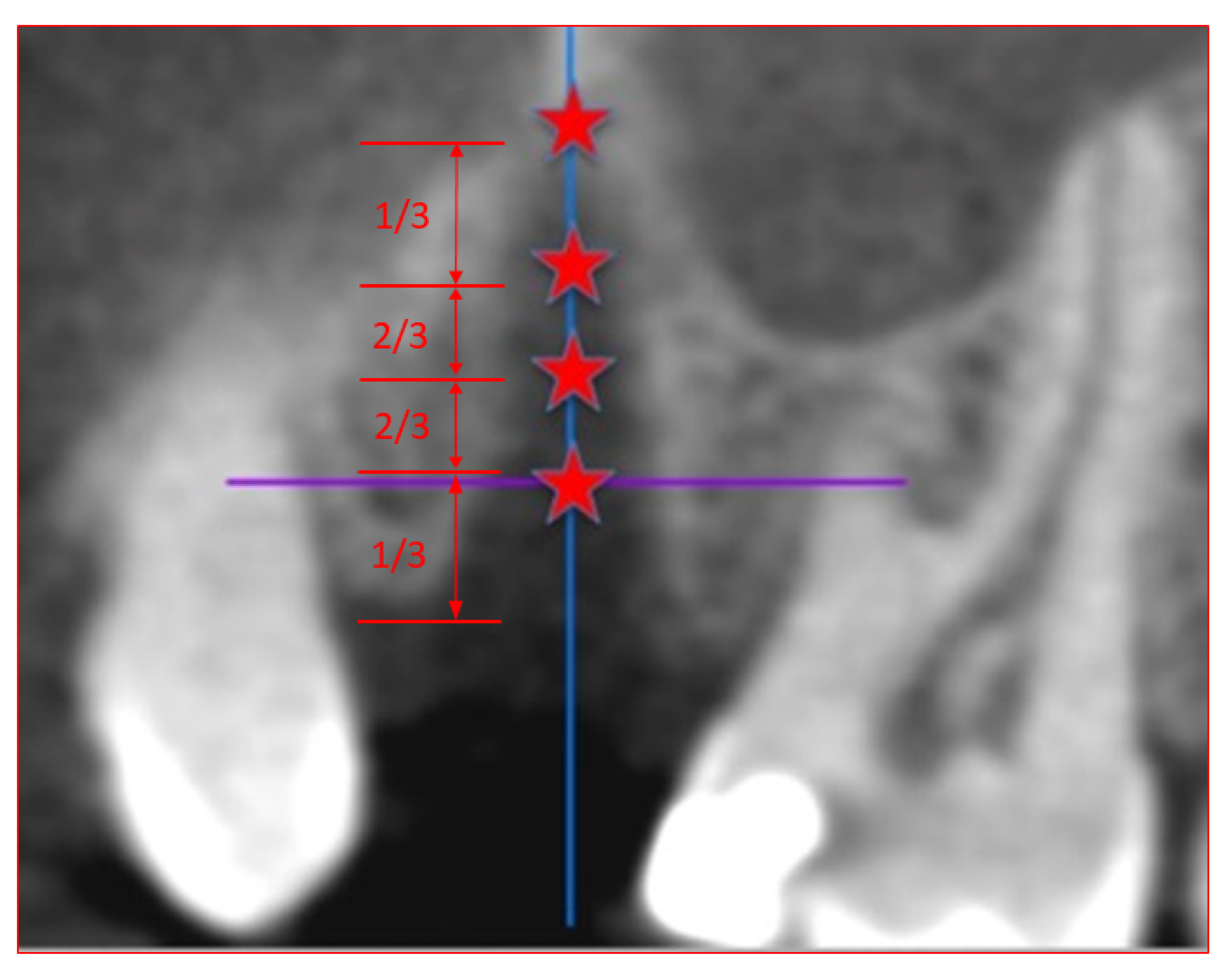 Dentistry 08 00112 g002