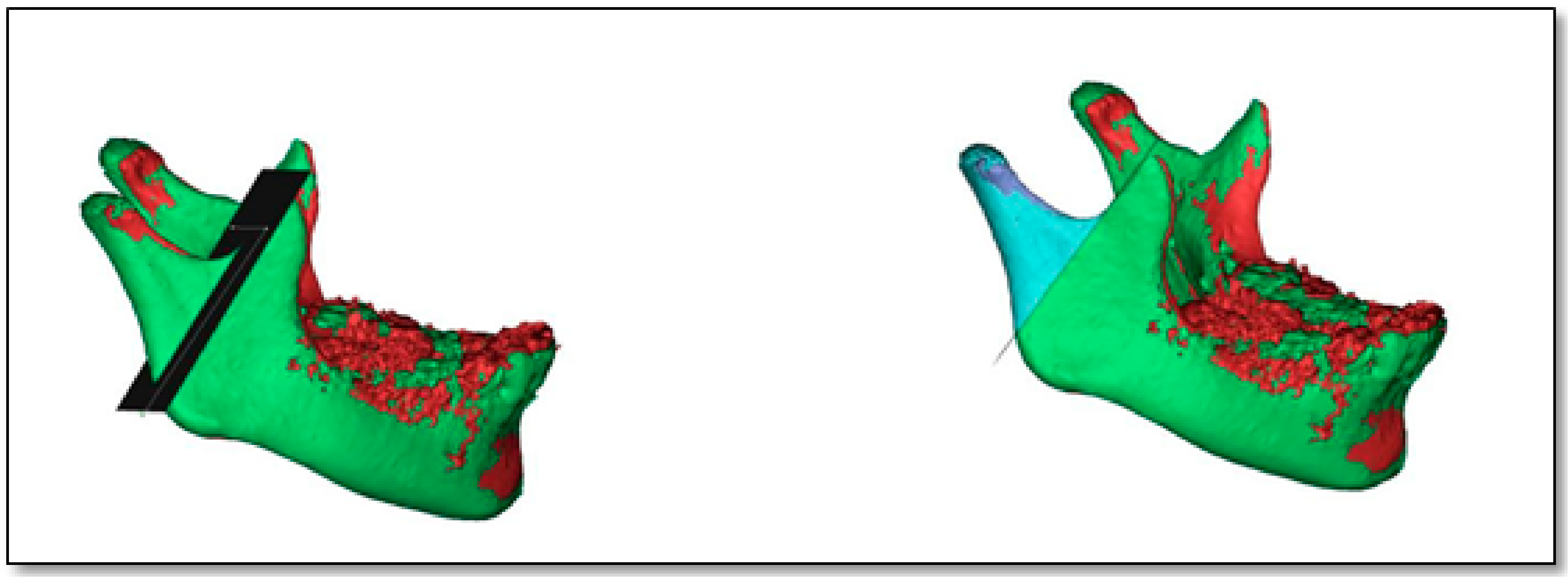 Dentistry 08 00115 g003