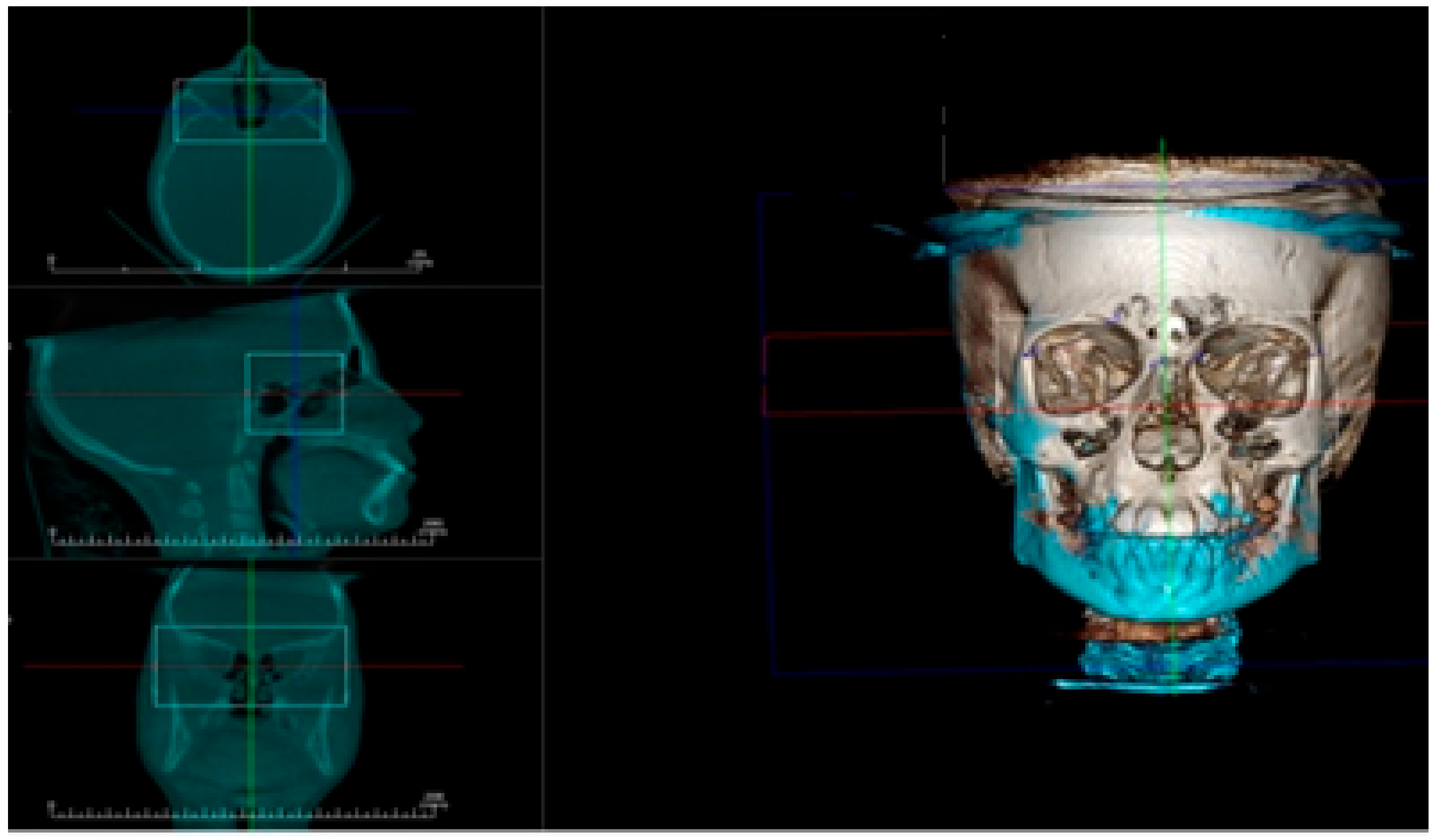 Dentistry 08 00115 g004