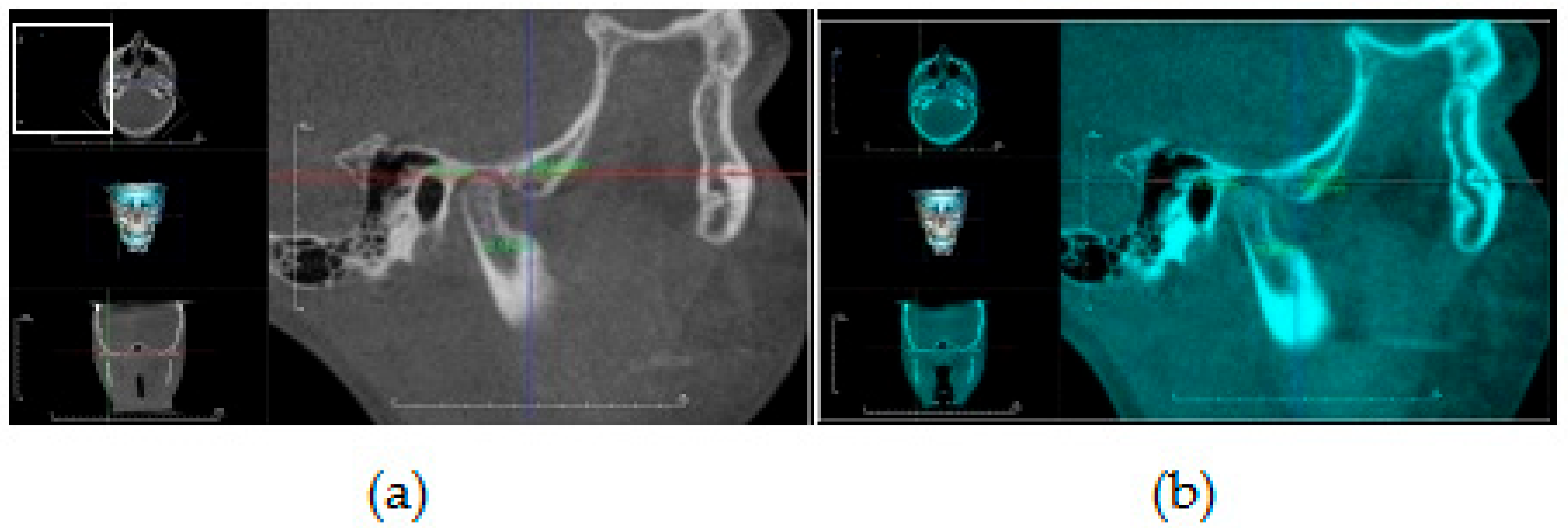 Dentistry 08 00115 g005