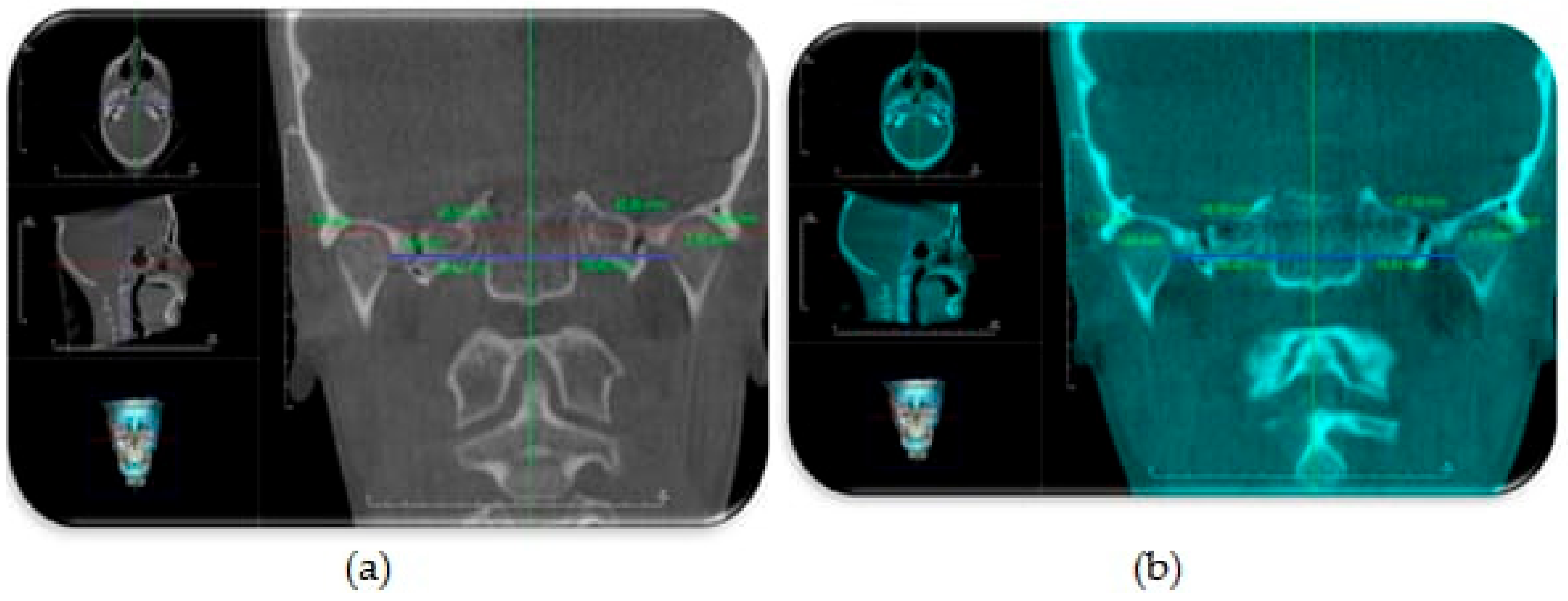 Dentistry 08 00115 g006