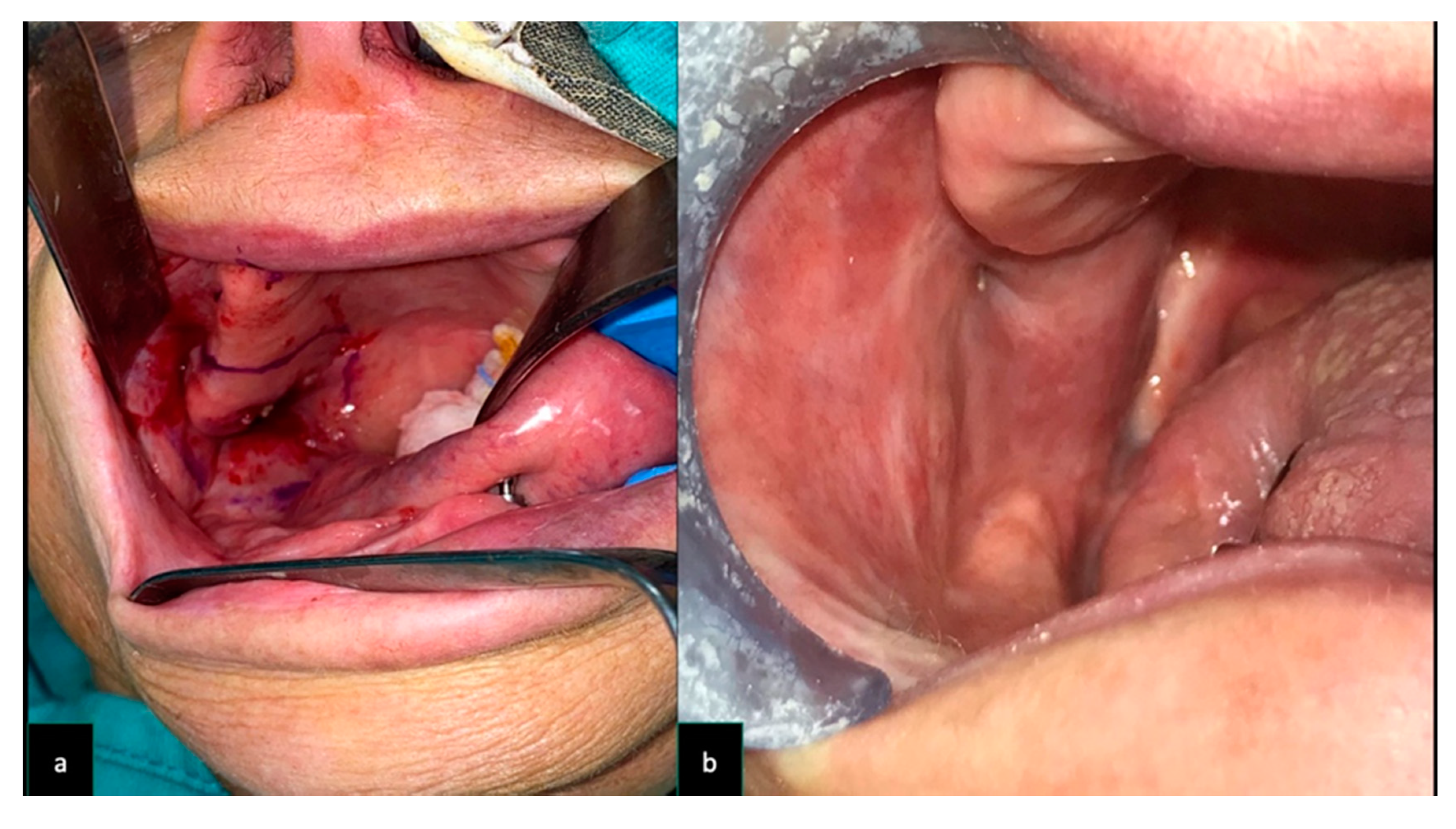 Dentistry 08 00117 g005