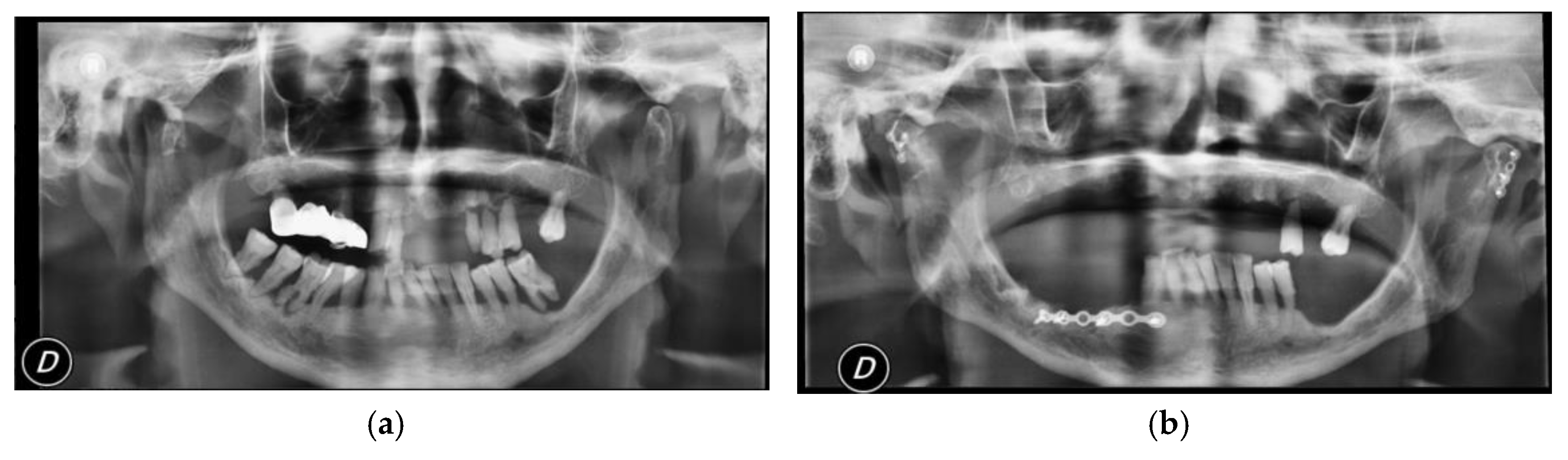 Dentistry 08 00125 g003