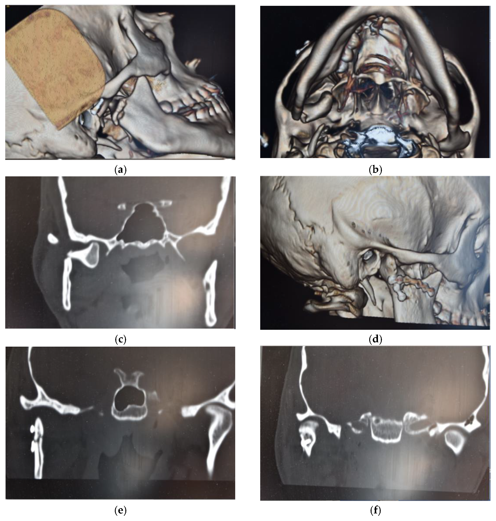Dentistry 08 00125 g004