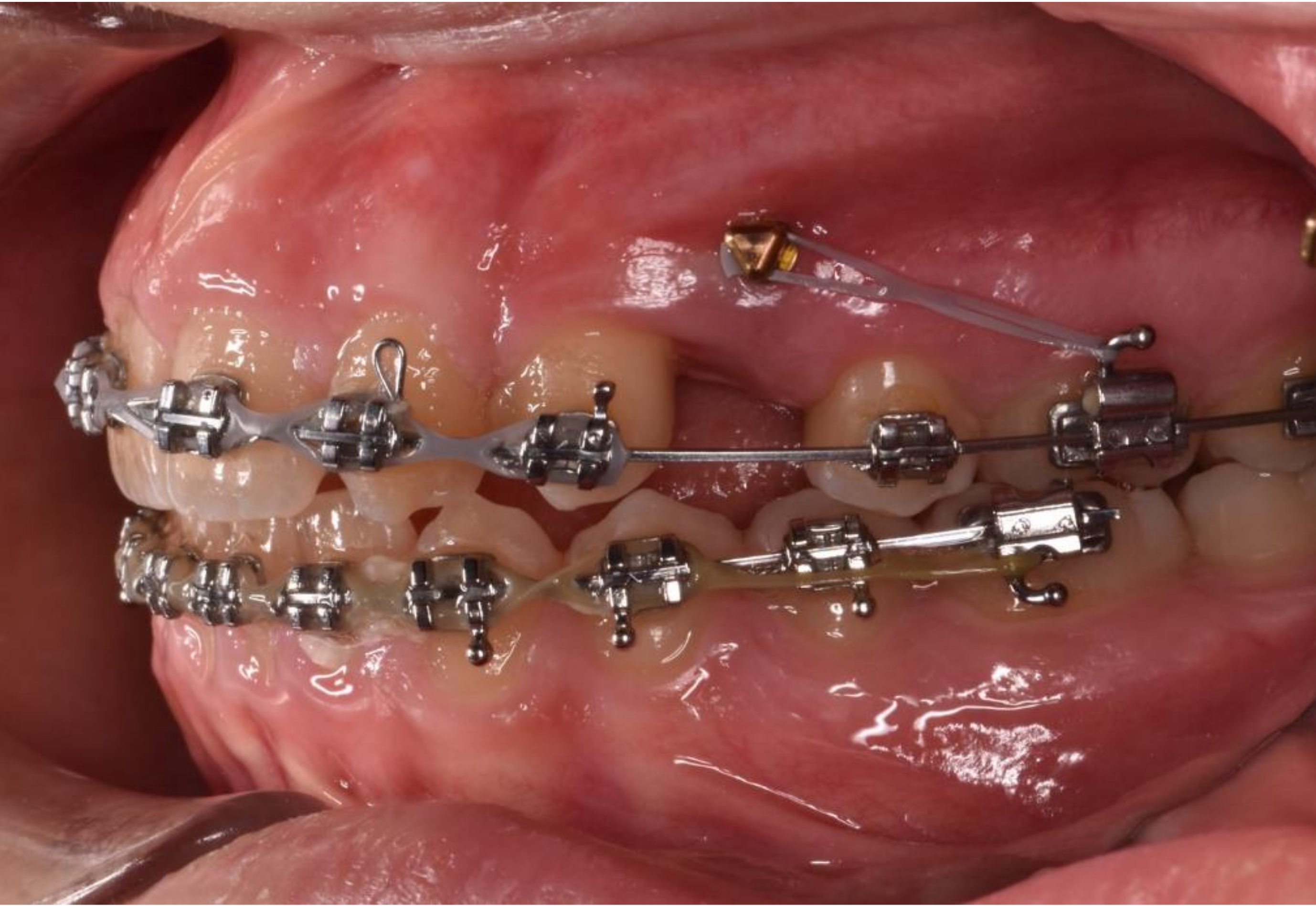 Dentistry 08 00126 g001 550