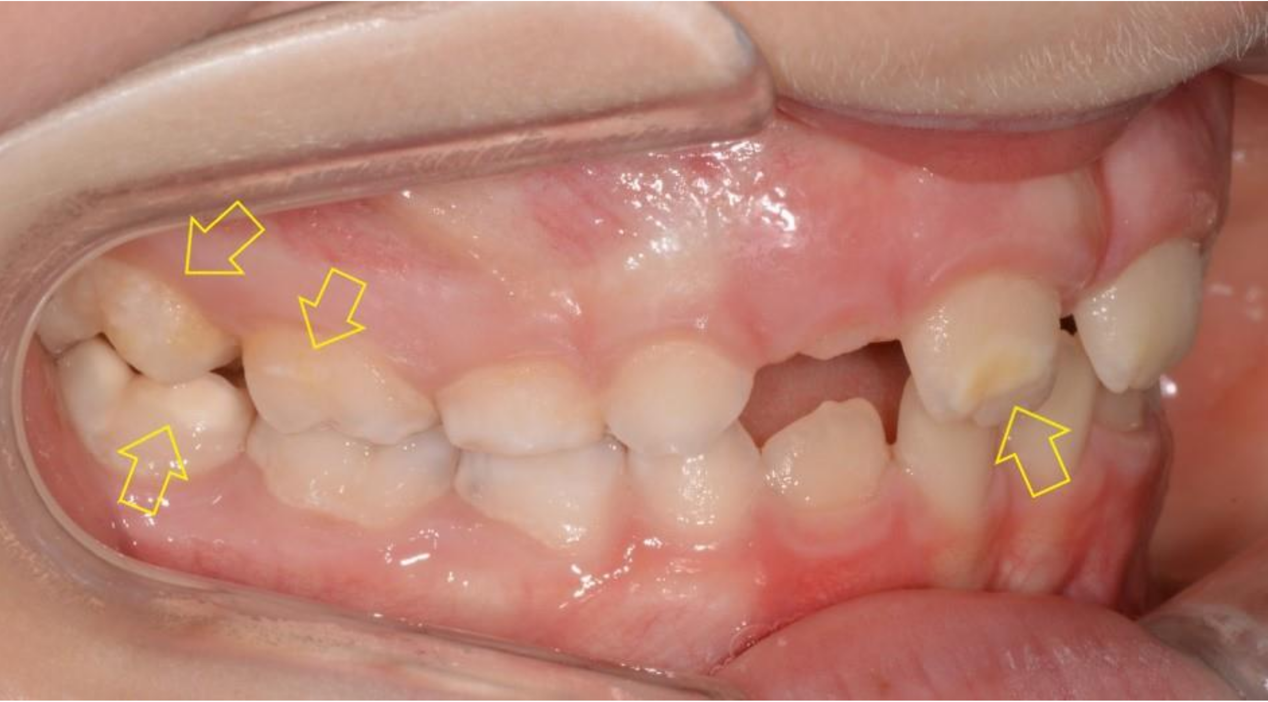 Dentistry 08 00126 g002 550